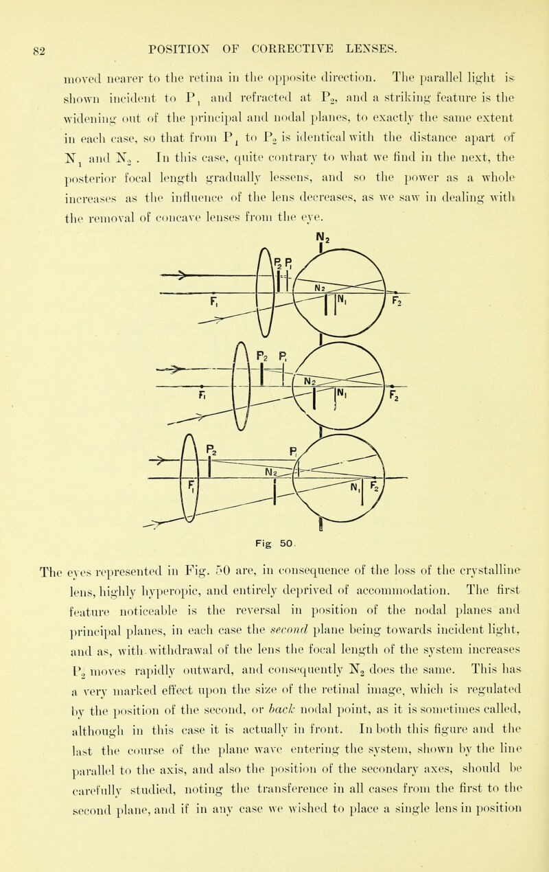 moved nearer to the retina in the opposite direction. The parallel light is- shown incident to P, and refracted at Pg, and a striking feature is the widening out of the principal and nodal planes, to exactly the same extent in each case, so that from P ^ to P2 is identical with the distance apart of and No • this case, quite contrary to what we find in the next, the posterior focal length gradually lessens, and so the power as a whole increases as the influence of the lens decreases, as we saw in dealing with, the removal of concave lenses from the eye. f F2 Fig 50. eyes represented in Fig. 50 are, in consequence of the loss of the crystalline lens, highly hyperopic, and entirely deprived of accommodation. The first feature noticeable is the reversal in position of the nodal planes and principal planes, in each case the second plane being towards incident light, and as, with, withdrawal of the lens the focal length of the system increases P2 moves rapidly outward, and consequently ^^^^ l^he same. This has a very marked effect upon the size of the retinal image, which is regulated by the position of the second, or hack nodal point, as it is sometimes called, although in this case it is actually in front. In both this figure and the last the course of the plane wave entering the system, shown by the line parallel to the axis, and also the position of the secondary axes, sliould be carefully studied, noting the transference in all cases friun the first to the second plane, and if in any case we wished to place a single lens in position