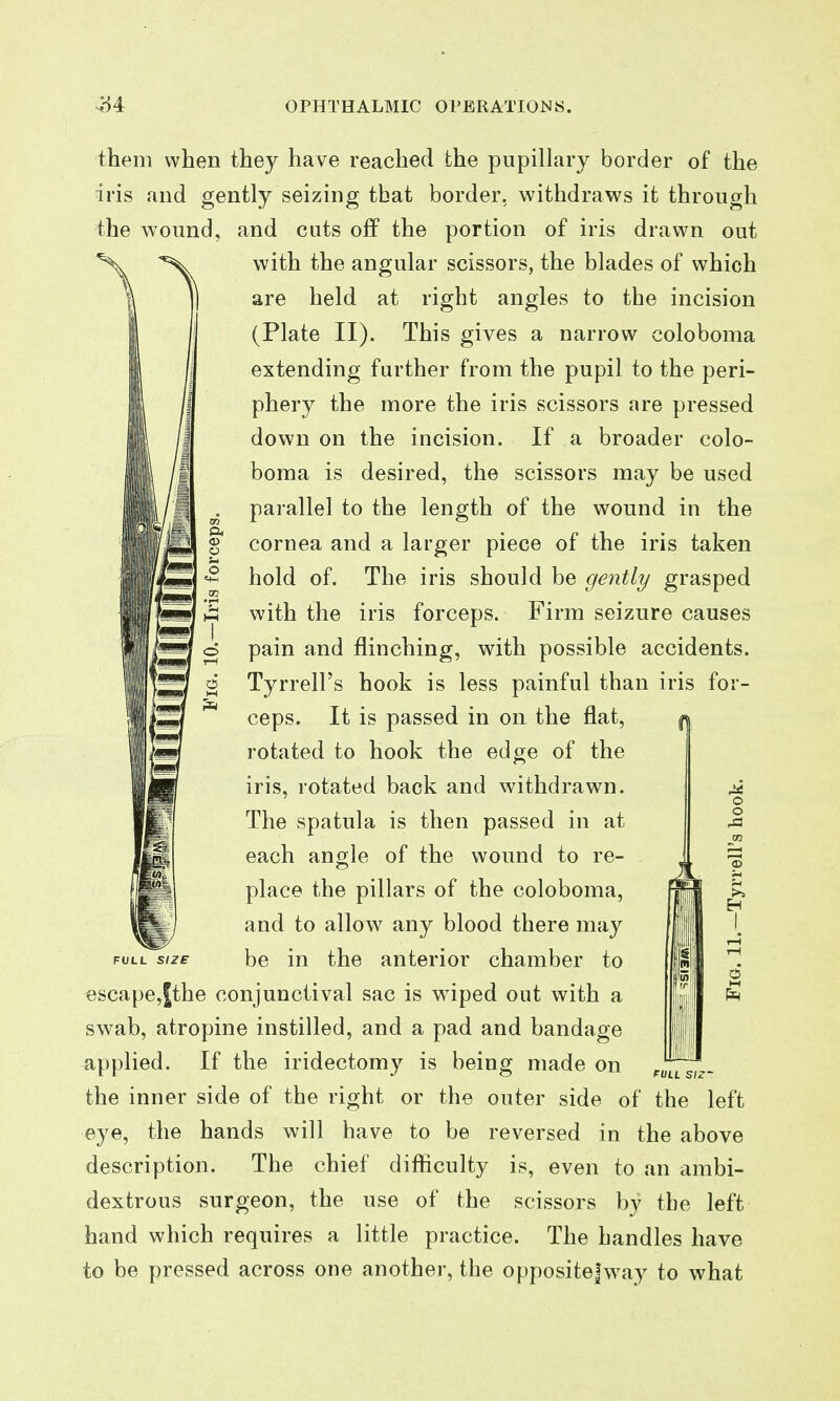 them when they have reached the pupillary border of the iris and gently seizing that border, withdraws it through the wound, and cuts off the portion of iris drawn out with the angular scissors, the blades of which are held at right angles to the incision (Plate II). This gives a narrow coloboma extending further from the pupil to the peri- phery the more the iris scissors are pressed down on the incision. If a broader colo- boma is desired, the scissors may be used ^ parallel to the length of the wound in the g cornea and a larger piece of the iris taken hold of. The iris should be gently grasped S\ with the iris forceps. Firm seizure causes o pain and flinching, with possible accidents. 6 Tyrrell's hook is less painful than iris for- ceps. It is passed in on the flat, rotated to hook the edge of the iris, rotated back and withdrawn. The spatula is then passed in at each angle of the wound to re- place the pillars of the coloboma, and to allow any blood there may FULL SIZE be in the anterior chamber to escape,Ithe conjunctival sac is wiped out with a swab, atropine instilled, and a pad and bandage applied. If the iridectomy is being made on the inner side of the right or the outer side of the left eye, the hands will have to be reversed in the above description. The chief difficulty is, even to an ambi- dextrous surgeon, the use of the scissors by the left hand which requires a little practice. The handles have to be pressed across one another, the opposite!way to what