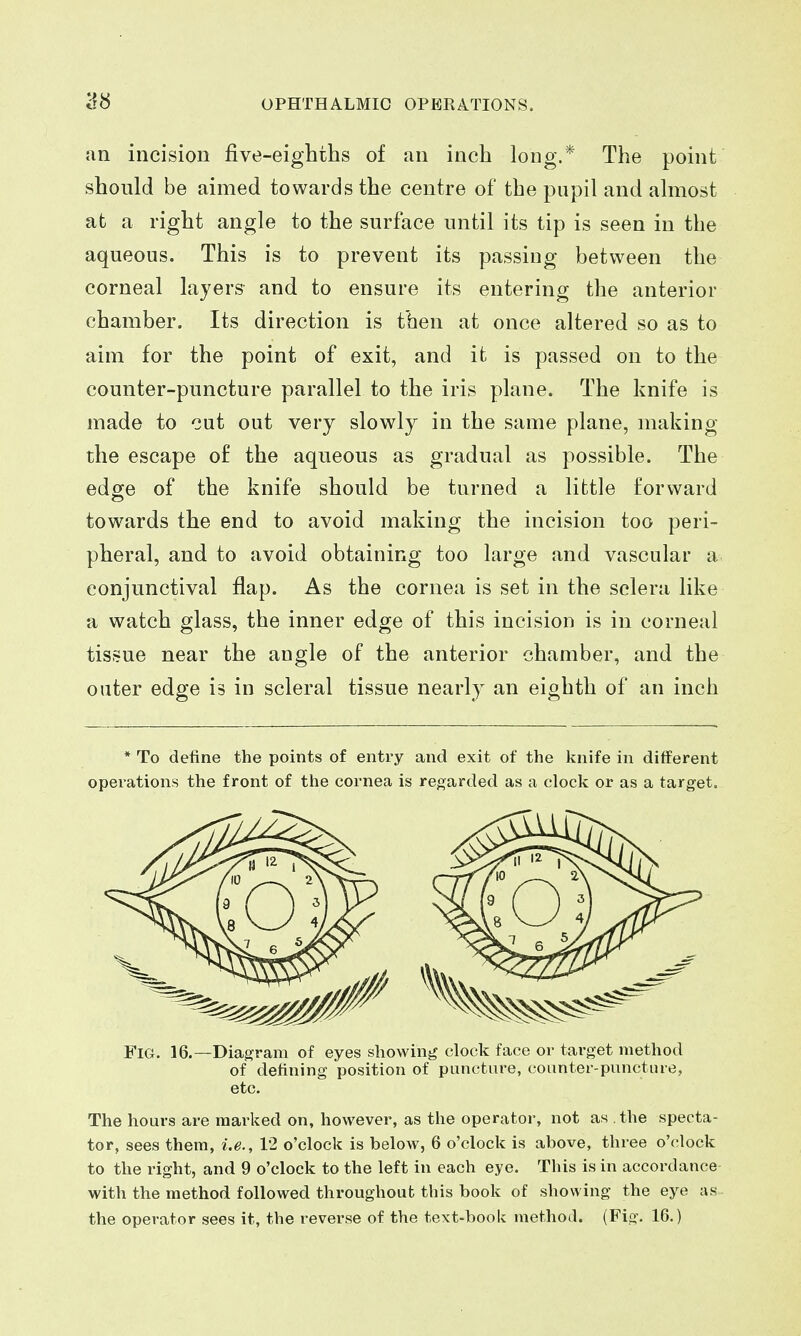 an incision five-eighths of an inch long.* The point should be aimed towards the centre of the pupil and almost at a right angle to the surface until its tip is seen in the aqueous. This is to prevent its passing between the corneal layers and to ensure its entering the anterior chamber. Its direction is then at once altered so as to aim for the point of exit, and it is passed on to the counter-puncture parallel to the iris plane. The knife is made to cut out very slowly in the same plane, making the escape of the aqueous as gradual as possible. The edge of the knife should be turned a little forward towards the end to avoid making the incision too peri- pheral, and to avoid obtaining too large and vascular a conjunctival flap. As the cornea is set in the sclera like a watch glass, the inner edge of this incision is in corneal tissue near the angle of the anterior chamber, and the outer edge is in scleral tissue nearly an eighth of an inch * To define the points of entry and exit of the knife in different operations the front of the cornea is regarded as a clock or as a target. Fig. 16.—Diagram of eyes showing clock face or target method of defining position of puncture, counter-puncture, etc. The hours are marked on, however, as the operator, not as the specta- tor, sees them, i.e., 12 o'clock is below, 6 o'clock is above, three o'clock to the right, and 9 o'clock to the left in each eye. This is in accordance with the method followed throughout this book of showing the eye as the operator sees it, the reverse of the text-book method. (Fig. 16.)