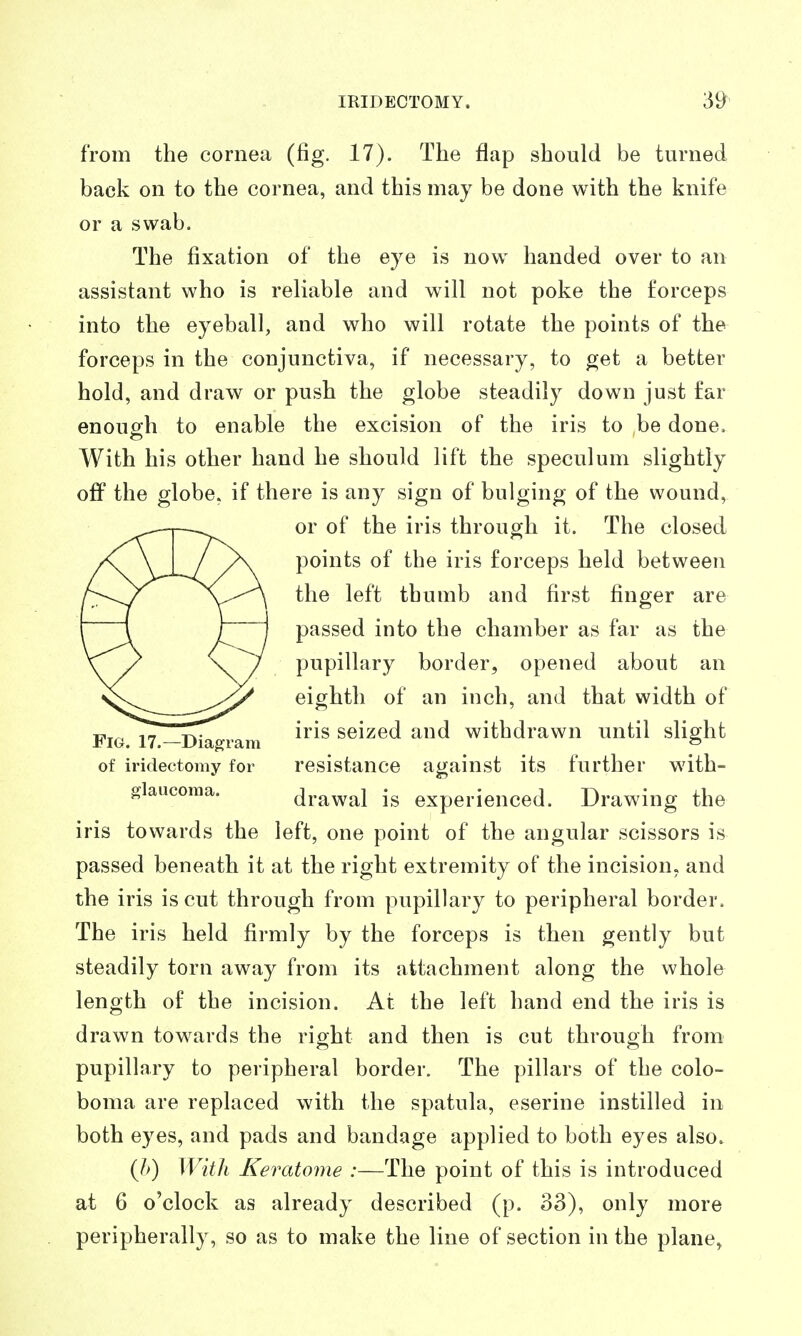 from the cornea (fig. 17). The flap should be turned back on to the cornea, and this may be done with the knife or a swab. The fixation of the eye is now handed over to an assistant who is reliable and will not poke the forceps into the eyeball, and who will rotate the points of the forceps in the conjunctiva, if necessary, to get a better hold, and draw or push the globe steadily down just far enough to enable the excision of the iris to be done. With his other hand he should lift the speculum slightly off the globe, if there is any sign of bulging of the wound, or of the iris through it. The closed points of the iris forceps held between the left thumb and first finger are passed into the chamber as far as the pupillary border, opened about an eighth of an inch, and that width of iris seized and withdrawn until slight resistance against its further with- drawal is experienced. Drawing the iris towards the left, one point of the angular scissors is passed beneath it at the right extremity of the incision, and the iris is cut through from pupillary to peripheral border. The iris held firmly by the forceps is then gently but steadily torn away from its attachment along the whole length of the incision. At the left hand end the iris is drawn towards the right and then is cut through from pupillary to peripheral border. The pillars of the colo- boma are replaced with the spatula, eserine instilled in both eyes, and pads and bandage applied to both eyes also. (/>) WitJi Keratome :—The point of this is introduced at 6 o'clock as already described (p. 33), only more peripherally, so as to make the line of section in the plane, Fig. 17.—Diagram of iridectomy for fflaucoraa.