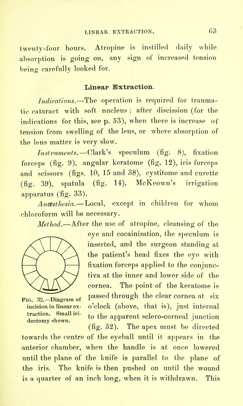 LINEAR EXTRACTION. twenty-fonr hours. Atropine is instilled daily while absorption is going on, any sign of increased tension being carefully looked for. Linear Extraction. Indications,—The operation is required for trauma- tic cataract with soft nucleus ; after discission (for the indications for this, see p. 53), when there is increase of tension from swelling of the lens, or where absorption of the lens matter is very slow. Instruments.—Clark's speculum (fig. 8), fixation forceps (fig. 9), angular keratome (fig. 12), iris forceps and scissors (figs. 10, 15 and 38), cystitome and curette (fig. 39), spatula (fig. 14), McKeown's irrigation apparatus (fig. 33). AnCBstliesia,—Local, except in children for whom chloroform will be necessary. Method,—After the use of atropine, cleansing of the eye and cocainisation, the speculum is inserted, and the surgeon standing at the patient's head fixes the eye with fixation forceps applied to the conjunc- tiva at the inner and lower side of the cornea. The point of the keratome is Fig s'TLDiagram of P^^^®^ through the clear cornea at six incision in linear ex- o'clock (above, that is), just internal traction. Small iri- apparent sclero-corneal junction dectomy shown. ^ ^ (fig. 32). The apex must be directed towards the centre of the eyeball until it appears in the anterior chamber, when the handle is at once lowered until the plane of the knife is parallel to the plane of the iris. The knife is then pushed on until the wound is a quarter of an inch long, when it is withdrawn. This