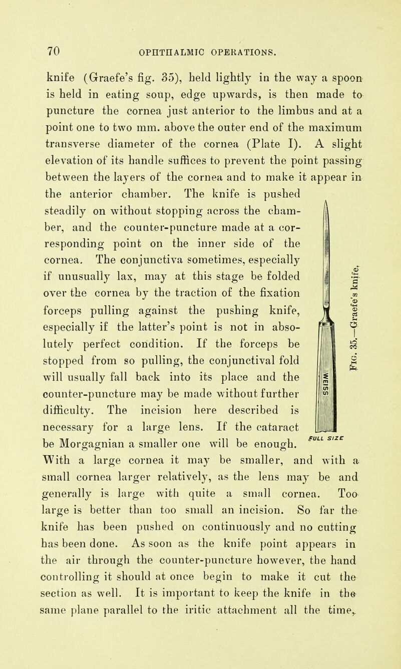 knife (Graefe's fig. 35), held lightly in the way a spoon is held in eating soup, edge upwards, is then made to puncture the cornea just anterior to the limbus and at a point one to two mm. above the outer end of the maximum transverse diameter of the cornea (Plate I). A slight elevation of its handle suffices to prevent the point passing between the layers of the cornea and to make it appear in the anterior chamber. The knife is pushed steadily on without stopping across the cham- ber, and the counter-puncture made at a cor- responding point on the inner side of the cornea. The conjunctiva sometimes, especially if unusually lax, may at this stage be folded over the cornea by the traction of the fixation forceps pulling against the pushing knife, especially if the latter's point is not in abso- lutely perfect condition. If the forceps be stopped from so pulling, the conjunctival fold will usually fall back into its place and the counter-puncture may be made without further difficulty. The incision here described is necessary for a large lens. If the cataract be Morgagnian a smaller one will be enough. ^'^^ With a large cornea it may be smaller, and with a small cornea larger relatively, as the lens may be and generally is large with quite a snudl cornea. Too large is better than too small an incision. So far the knife has been pushed on continuously and no cutting has been done. As soon as the knife point appears in the air through the counter-puncture however, the hand controlling it should at once begin to make it cut the section as well. It is important to keep the knife in the same plane parallel to the iritic attachment all the time,