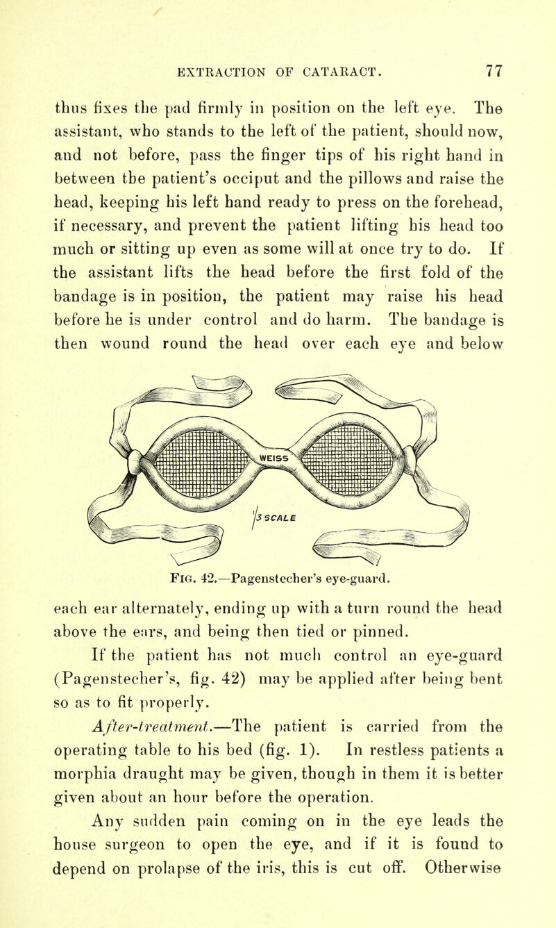 thus fixes the pad firmly in position on the left eye. The assistant, who stands to the left of the patient, should now, and not before, pass the finger tips of his right hand in between the patient's occiput and the pillows and raise the head, keeping his left hand ready to press on the forehead, if necessary, and prevent the patient lifting his head too much or sitting up even as some will at once try to do. If the assistant lifts the head before the first fold of the bandage is in position, the patient may raise his head before he is under control and do harm. The bandage is then wound round the head over each eye and below Fig. 42.—Pagenstechei-'s eye-guard. each ear alternately, ending up with a turn round the head above the ears, and being then tied or pinned. If the patient has not much control an eye-guard (Pagenstecher's, fig. 42) may be applied after being bent so as to fit properly. After-treatment.—The patient is carried from the operating table to his bed (fig. 1). In restless patients a morphia draught may be given, though in them it is better given about an hour before the operation. Any sudden pain coming on in the eye leads the house surgeon to open the eye, and if it is found to depend on prolapse of the iris, this is cut off. Otherwise