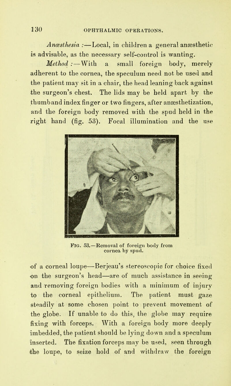 Anaesthesia :—Local, in children a general anaesthetic is advisable, as the necessary self-control is wanting. Method : — With a small foreign body, merely adherent to the cornea, the speculum need not be used and the patient may sit in a chair, the head leaning back against the surgeon's chest. The lids may be held apart by the thumband index finger or two fingers, after ansesthetization, and the foreign body removed with the spud held in the right hand (fig. 53). Focal illumination and the use Fig. 53.—Removal of foreign body from cornea by spud. ■of a corneal loupe—Berjeau's stereoscopic for choice fixed on the surgeon's head—are of much assistance in seeing and removing foreign bodies with a minimum of injury to the corneal epithelium. The patient must gaze steadily at some chosen point to prevent movement of the globe. If unable to do this, the globe may require fixing with forceps. With a foreign body more deepl}^ imbedded, the patient should be lying down and a speculum inserted. The fixation forceps may be used, seen through the loupe, to seize hold of and withdraw the foreign