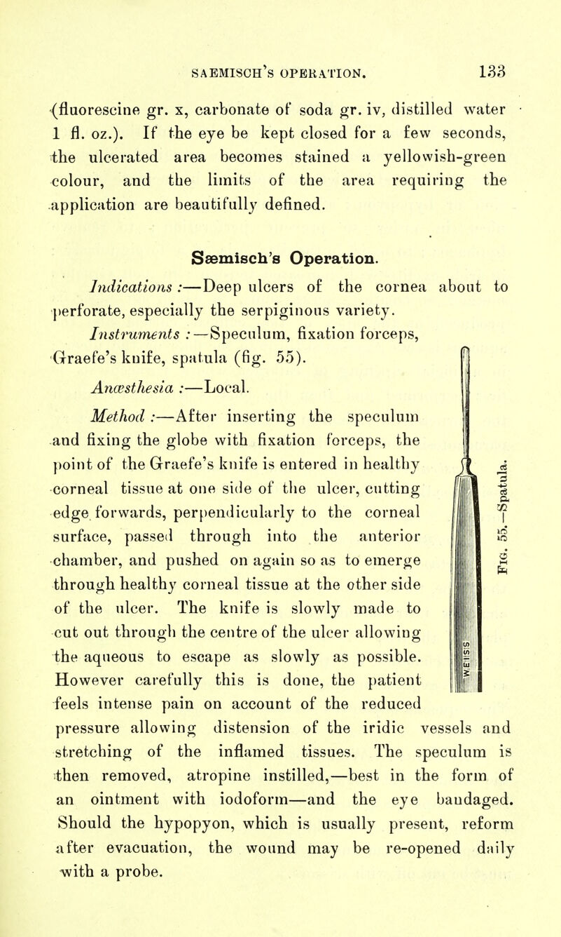 (fluorescine gr. x, carbonate of soda gr. iv, distilled water 1 fl. oz.). If the eye be kept closed for a few seconds, the ulcerated area becomes stained a yellowish-green colour, and the limits of the area requiring the application are beautifully defined. Ssemisch's Operation. Indications :—Deep ulcers o£ the cornea about to perforate, especially the serpiginous variety. Instruments :—Speculum, fixation forceps, Graefe's knife, spatula (fig. 55). Anaesthesia :—Local. Method :—After inserting the speculum and fixing the globe with fixation forceps, the })oi!it of the Graefe's knife is entered in healthy corneal tissue at one side of the ulcer, cutting edge, forwards, perpendicularly to the corneal surface, passed through into the anterior chamber, and pushed on again so as to emerge through healthy corneal tissue at the other side of the ulcer. The knife is slowly made to cut out through the centre of the ulcer allowing the aqueous to escape as slowly as possible. However carefully this is done, the patient feels intense pain on account of the reduced pressure allowing distension of the iridic vessels and stretching of the inflamed tissues. The speculum is then removed, atropine instilled,—best in the form of an ointment with iodoform—and the eye bandaged. Should the hypopyon, which is usually present, reform after evacuation, the wound may be re-opened daily with a probe.