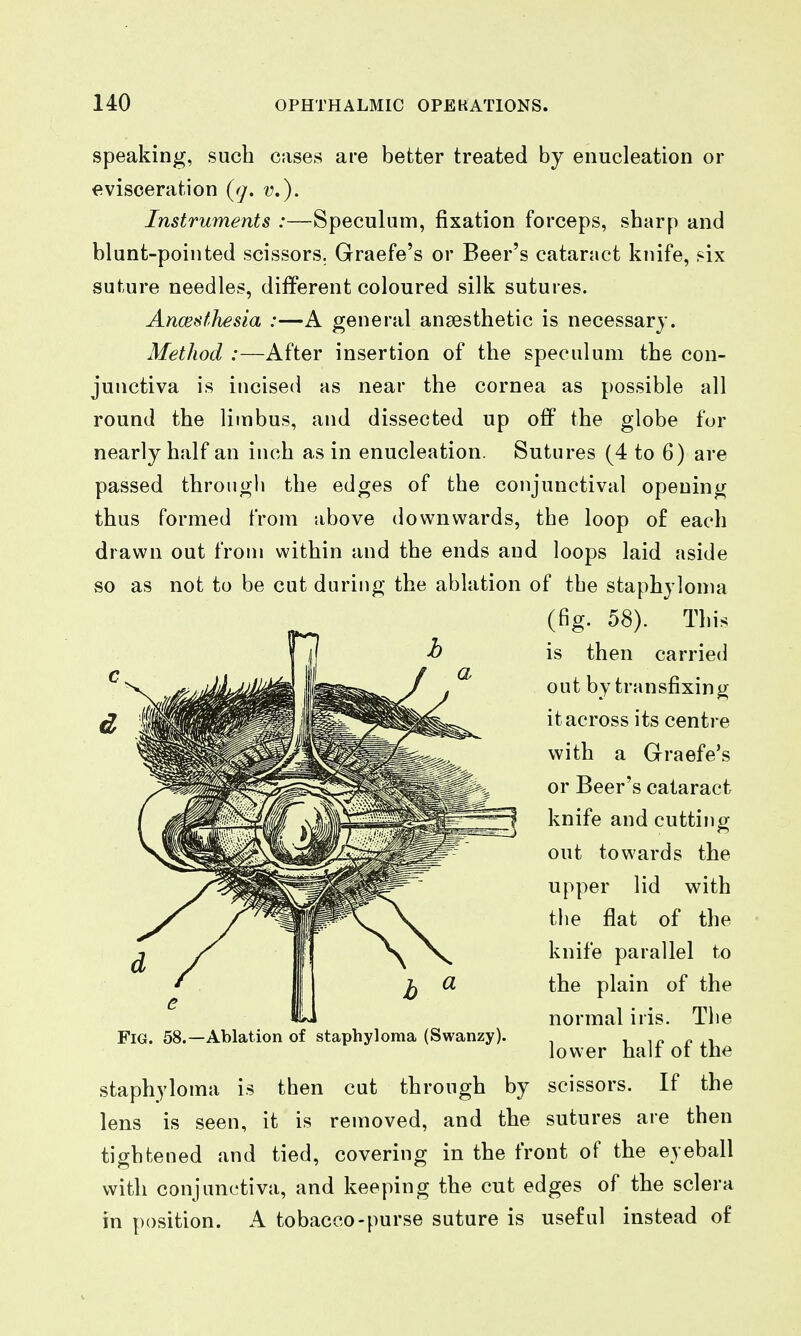 speaking, such cases are better treated by enucleation or evisceration v.). Instruments :—Speculum, fixation forceps, sharp and blunt-pointed scissors. Graefe's or Beer's cataract knife, six suture needles, different coloured silk sutures. Ancesthesia :—A general anaesthetic is necessary. Method :—After insertion of the speculum the con- junctiva is incised as near the cornea as possible all round the limbus, and dissected up off the globe for nearly half an inch as in enucleation. Sutures (4 to 6) are passed throngli the edges of the conjunctival opening thus formed from above downwards, the loop of each drawn out from within and the ends and loops laid aside so as not to be cut during the ablation of the staphyloma (fig. 58). This ^ is then carried out by transfixing it across its centre with a Graefe's or Beer's cataract knife and cutting out towards the upper lid with the flat of the knife parallel to the plain of the normal iris. Tlie lower half of the staphyloma is then cut through by scissors. If the lens is seen, it is removed, and the sutures are then tightened and tied, covering in the front of the eyeball with conjunctiva, and keeping the cut edges of the sclera in position. A tobacco-purse suture is useful instead of Fig. 58.—Ablation of staphyloma (Swanzy).