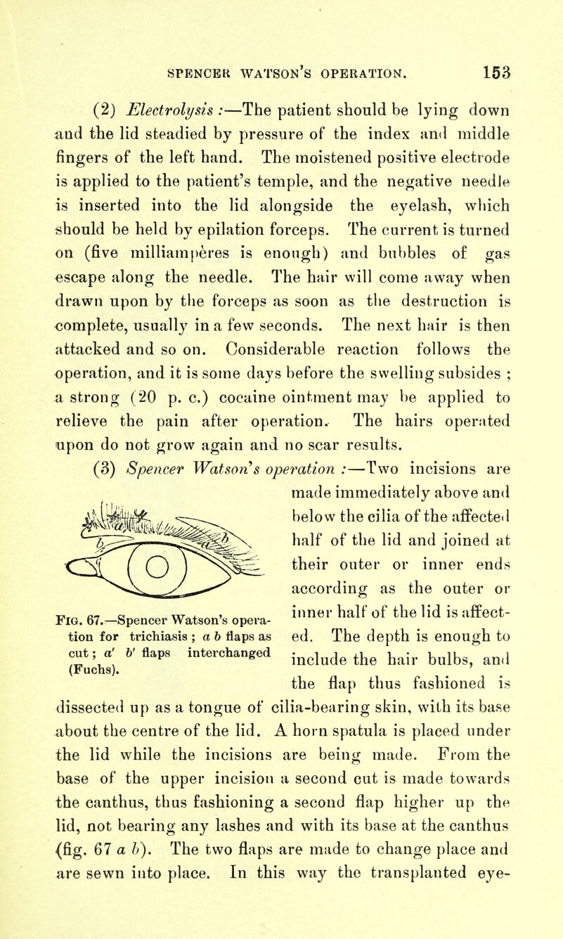 (2) Electrolysis :—The patient should be lying down and the lid steadied by pressure of the index and middle fingers of the left hand. The moistened positive electrode is applied to the patient's temple, and the negative needJe is inserted into the lid alongside the eyelash, which should be held by epilation forceps. The current is turned on (five milliamperes is enough) and bubbles of gas escape along the needle. The hair will come away when drawn upon by tlie forceps as soon as tlie destruction is complete, usually in a few seconds. The next hair is then attacked and so on. Considerable reaction follows the operation, and it is some days before the swelling subsides ; a strong (20 p. c.) cocaine ointment may be applied to relieve the pain after operation. The hairs operated upon do not grow again and no scar results. (3) Spencer Watson s ope^^ation :—Two incisions are made immediately above and below the cilia of the affected half of the lid and joined at their outer or inner ends according as the outer or inner half of the lid is affect- ed. The depth is enough to include the hair bulbs, and the flap thus fashioned is dissected up as a tongue of cilia-bearing skin, with its base about the centre of the lid. A horn spatula is placed under the lid while the incisions are being made. From the base of the upper incision a second cut is made towards the canthus, thus fashioning a second flap higher up the lid, not bearing any lashes and with its base at the canthus (fig. 67 a h). The two flaps are made to change place and are sewn into place. In this way the transplanted eye- FlG. 67.—Spencer Watson's opera- tion for trichiasis ; a 6 flaps as cut; a' b' flaps interchanged (Fuchs).