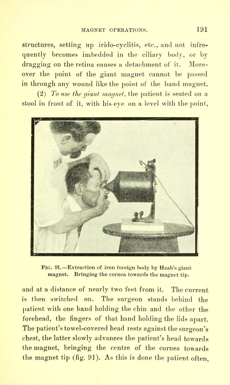 structures, setting up irido-cyclitis, etc., and not infre- quently becomes imbedded in the ciliary body, or by dragging on the retina causes a detachment of it. More- over the point of the giant magnet cannot be passed in through any wound like the point of the hand magnet. (2) 7o use the giant magnet, the patient is seated on a stool in front o£ it, with his eye on a level with the point, Fig. 91.—Extraction of iron foreign body by Haab's giant magnet. Bringing the cornea towards the magnet tip. and at a distance of nearly two feet from it. The current is then switched on. The surgeon stands behind the patient witli one hand holding the chin and the other the forehead, the fingers of that hand holding the lids apart. The patient's towel-covered head rests against the surgeon's chest, the latter slowly advances the patient's head towards the magnet, bringing the centre of the cornea towards the magnet tip (fig. 91). As this is done the patient often,