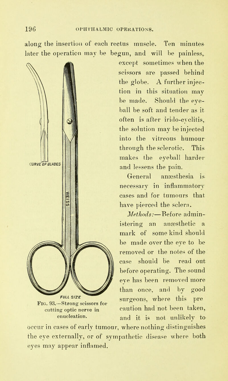 along the insertion of each rectus muscle. Ten minutes later the operation may be begun, and will be painless^ except sometimes when tho scissors are passed behind the globe. A further injec- tion in this situation may be made. Should the eye- ball be soft and tender as it often is after irido-cyclitis, the solution may be injected into the vitreous humour through the sclerotic. This makes the eyeball hardei- and lessens the pnin. General anaesthesia is necessary in inflammatory cases and for tumours that have pierced the sclern. Methods:—Before admin- istering an anaesthetic a mark of some kind should be made over the eye to be removed or the notes of the case should be read out before operating. The sound eye has been removed more than once, and by good surgeons, where this pre caution had not been taken, and it is not unlikely to occur in cases of early tumour, where nothing distinguishes the eye externally, or of sympathetic disease where both eyes may appear inflamed. FULL SIZE Fig. 93.—Strong scissors for cutting optic nerve in enucleation.