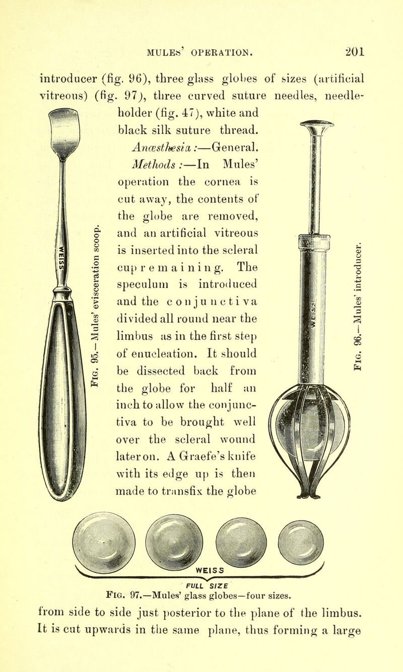 introducer (fig. 96), three glass globes of sizes (artificial vitreous) (fig. 97J, three curved suture needles, needle- holder (fig. 47), white and black silk suture thread. AncestlyesicL:—General. Methods ;—In Mules' operation the cornea is cut away, the contents of the globe are removed, ^ and an artificial vitreous \ is inserted into the scleral I cup remaining. The I speculum is introduced ; and the conjunctiva I divided all round near the limbus as in the first step of enucleation. It should be dissected back from the globe for half an inch to allow the conjunc- tiva to be brought well over the scleral wound lateron. A Graefe's knife with its edge up is then made to transfix the globe FULL SIZE Fig. 97.—Mules' glass globes—four sizes, from side to side just posterior to the plane of the limbus. It is cut upwards in the same plane, thus forming a large