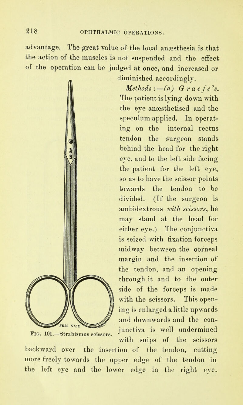 advantage. The great value o£ the local anaesthesia is that the action of the muscles is not suspended and the effect of the operation can be judged at once, and increased or diminished accordingly. Methods :—(a) G r a e f e''s^ The patient is lying down with the eye ansesthetised and the speculum applied. In operat- ing on the internal rectus tendon the surgeon stands behind the head for the right eye, and to the left side facing the patient for the left eye^ so as to have the scissor points towards the tendon to be divided. (If the surgeon is ambidextrous icitli scissors, he may stand at the head for either eye.) The conjunctiva is seized with fixation forceps midway between the corneal margin and the insertion of the tendon, and an opening through it and to the outer side of the forceps is made with the scissors. This open- ing is enlarged a little upwards and downwards and the con- junctiva is well undermined with snips of the scissors backward over the insertion of the tendon, cutting more freely towards the upper edge of the tendon in the left eye and the lower edge in the right eye. FVIL SIZE Fig. 101.—Strabismus scissors.