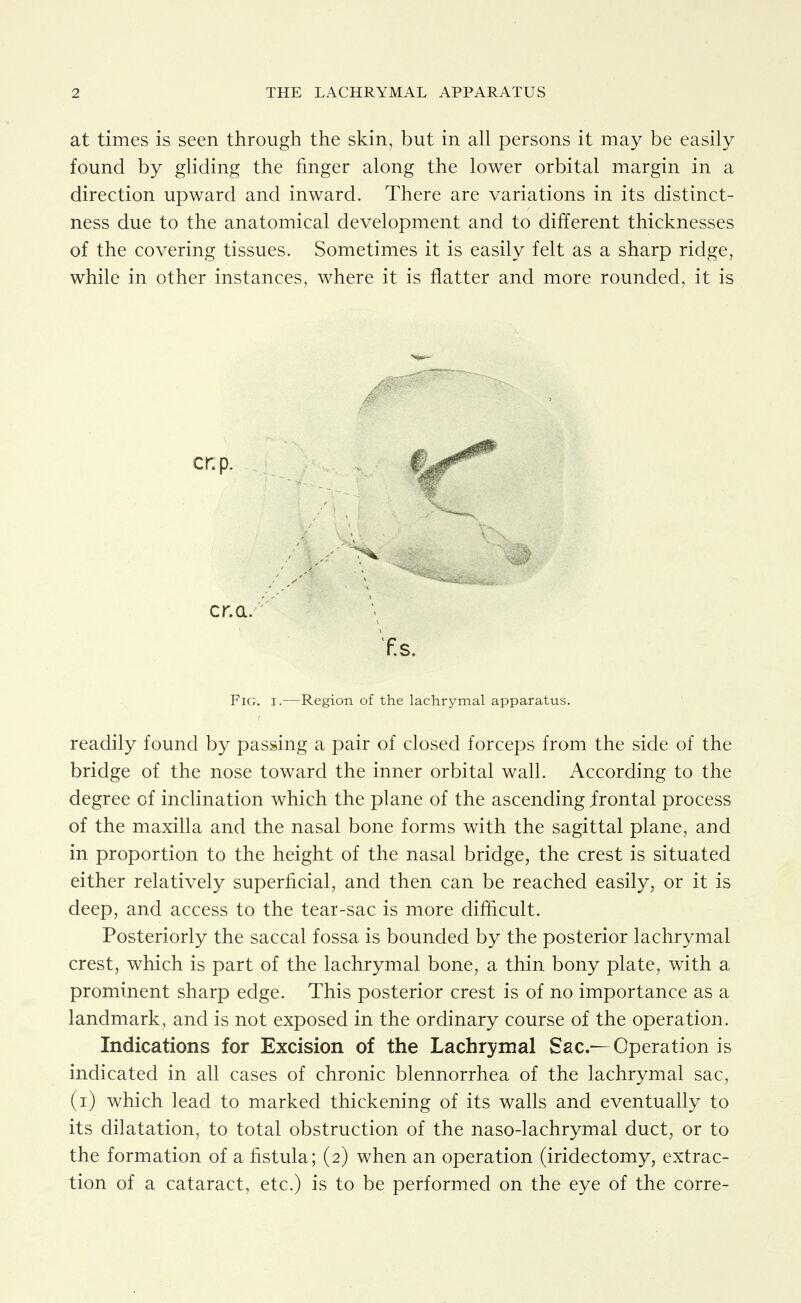 at times is seen through the skin, but in all persons it may be easily found by gliding the finger along the lower orbital margin in a direction upward and inward. There are variations in its distinct- ness due to the anatomical development and to different thicknesses of the covering tissues. Sometimes it is easily felt as a sharp ridge, while in other instances, where it is flatter and more rounded, it is cr.a. f.s. Fig. I.—Region of the lachrymal apparatus. readily found by passing a pair of closed forceps from the side of the bridge of the nose toward the inner orbital wall. According to the degree of incHnation which the plane of the ascending frontal process of the maxilla and the nasal bone forms with the sagittal plane, and in proportion to the height of the nasal bridge, the crest is situated either relatively superficial, and then can be reached easily, or it is deep, and access to the tear-sac is more diflicult. Posteriorly the saccal fossa is bounded by the posterior lachrymal crest, which is part of the lachrymal bone, a thin bony plate, with a prominent sharp edge. This posterior crest is of no importance as a landmark, and is not exposed in the ordinary course of the operation. Indications for Excision of the Lachrymal Sac.— Operation is indicated in all cases of chronic blennorrhea of the lachrymal sac, (i) which lead to marked thickening of its walls and eventually to its dilatation, to total obstruction of the naso-lachrymal duct, or to the formation of a fistula; (2) when an operation (iridectomy, extrac- tion of a cataract, etc.) is to be performed on the eye of the corre-