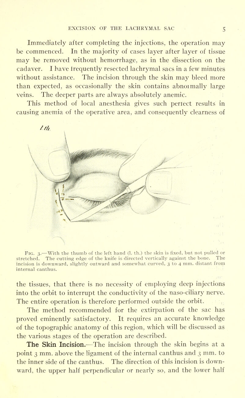 Immediately after completing the injections, the operation may be commenced. In the majority of cases layer after layer of tissue may be removed without hemorrhage, as in the dissection on the cadaver. I have frequently resected lachrymal sacs in a few minutes without assistance. The incision through the skin may bleed more than expected, as occasionally the skin contains abnoimally large veins. The deeper parts are always absolutely anemic. i This method of local anesthesia gives such periect results in causing anemia of the operative area, and consequently clearness of Itk Fig. 3.—With the thumb of the left hand (h th.) the skin is fixed, but not pulled or stretched. The cutting edge of the knife is directed vertically against the bone. The incision is downward, slightly outward and somewhat curved, 3 to 4 mm. distant frorn. internal canthus. ! ; I ! ' the tissues, that there is no necessity of employing deep injections into the orbit to interrupt the conductivity of the naso-cihary nerve. The entire operation is therefore performed outside the orbit. The method recommended for the extirpation of the sac has proved eminently satisfactory. It requires an accurate knowledge of the topographic anatomy of this region, which will be discussed as the various stages of the operation are described. The Skin Incision.—The incision through the skin begins at a point 3 mm. above the ligament of the internal canthus and 3 mm. to the inner side of the canthus. The direction of this incision is down- ward, the upper half perpendicular or nearly so, and the lower half