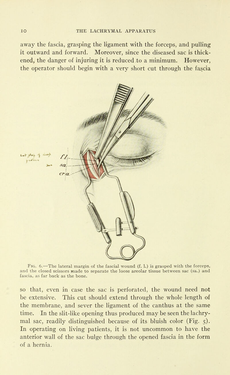 away the fascia, grasping the ligament with the forceps, and pulling it outward and forward. Moreover, since the diseased sac is thick- ened, the danger of injuring it is reduced to a minimum. However, the operator should begin with a very short cut through the fascia Fig. 6.—The lateral margin of the fascial wound (f. 1.) is grasped with the forceps, and the closed scissors made to separate the loose areolar tissue between sac (sa.) and fascia, as far back as the bone. so that, even in case the sac is perforated, the wound need not be extensive. This cut should extend through the whole length of the membrane, and sever the ligament of the canthus at the same time. In the slit-like opening thus produced may be seen the lachry- mal sac, readily distinguished because of its bluish color (Fig. 5). In operating on living patients, it is not uncommon to have the anterior wall of the sac bulge through the opened fascia in the form of a hernia.