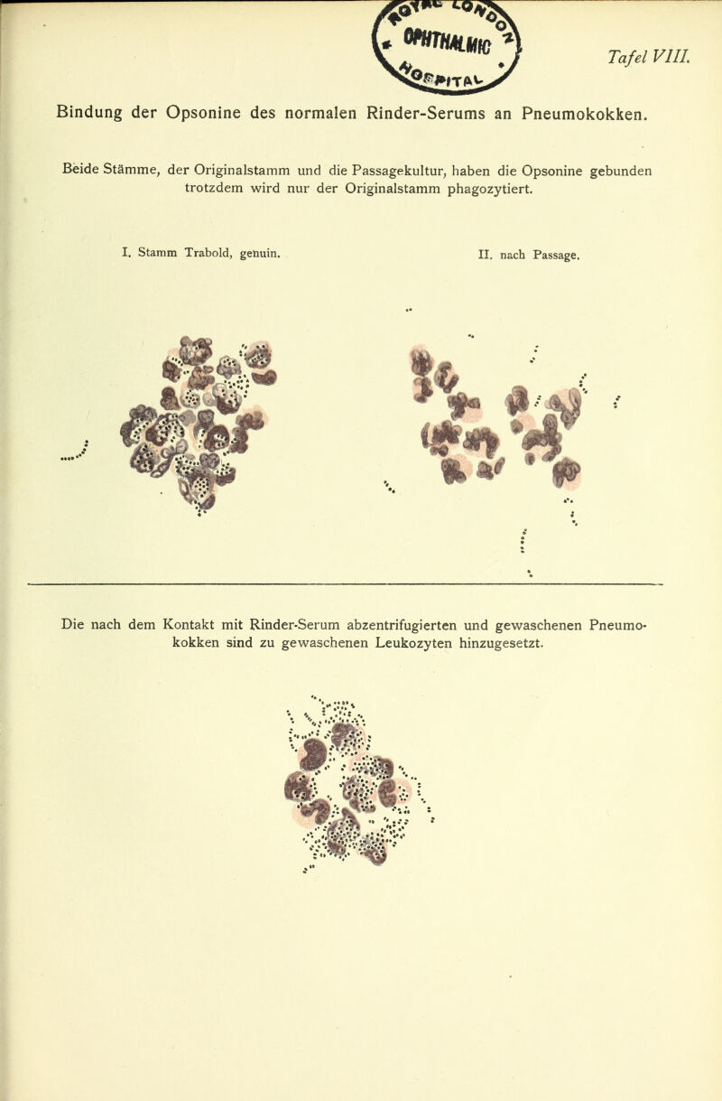 Bindung der Opsonine des normalen Rinder-Serums an Pneumokokken. Beide Stämme, der Originalstamm und die Passagekultur, haben die Opsonine gebunden trotzdem wird nur der Originalstamm phagozytiert. I. Stamm Trabold, gehuin. II. nach Passage. Die nach dem Kontakt mit Rinder-Serum abzentrifugierten und gewaschenen Pneumo- kokken sind zu gewaschenen Leukozyten hinzugesetzt. WS