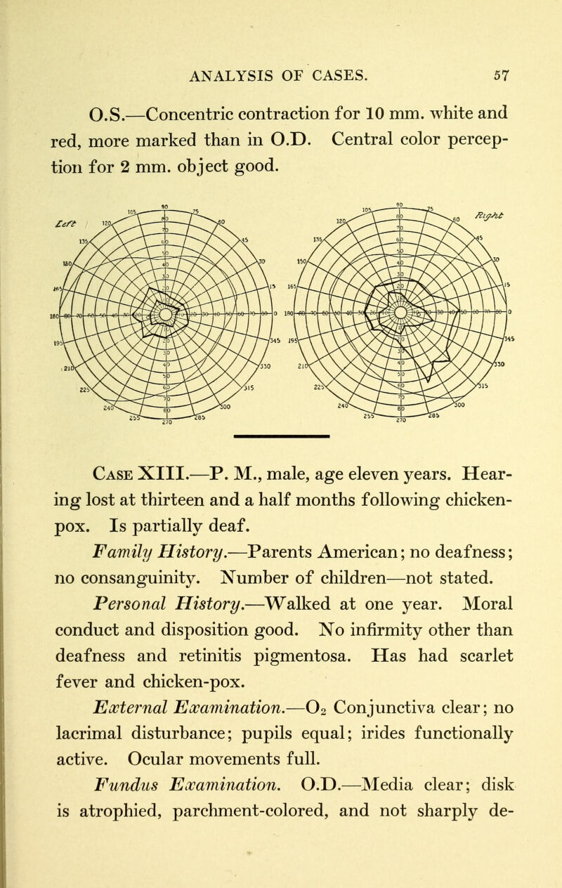 O.S.—Concentric contraction for 10 mm. white and red, more marked than in O.D. Central color percep- tion for 2 mm. object good. Case XIII.—P. M., male, age eleven years. Hear- ing lost at thirteen and a half months following chicken- pox. Is partially deaf. Family History.—Parents American; no deafness; no consanguinity. Number of children—not stated. Personal History,—^Walked at one year. Moral conduct and disposition good. No infirmity other than deafness and retinitis pigmentosa. Has had scarlet fever and chicken-pox. Eocternal Examination.—O2 Conjunctiva clear; no lacrimal disturbance; pupils equal; irides functionally active. Ocular movements full. Fundus Examination. O.D.—Media clear; disk is atrophied, parchment-colored, and not sharply de-