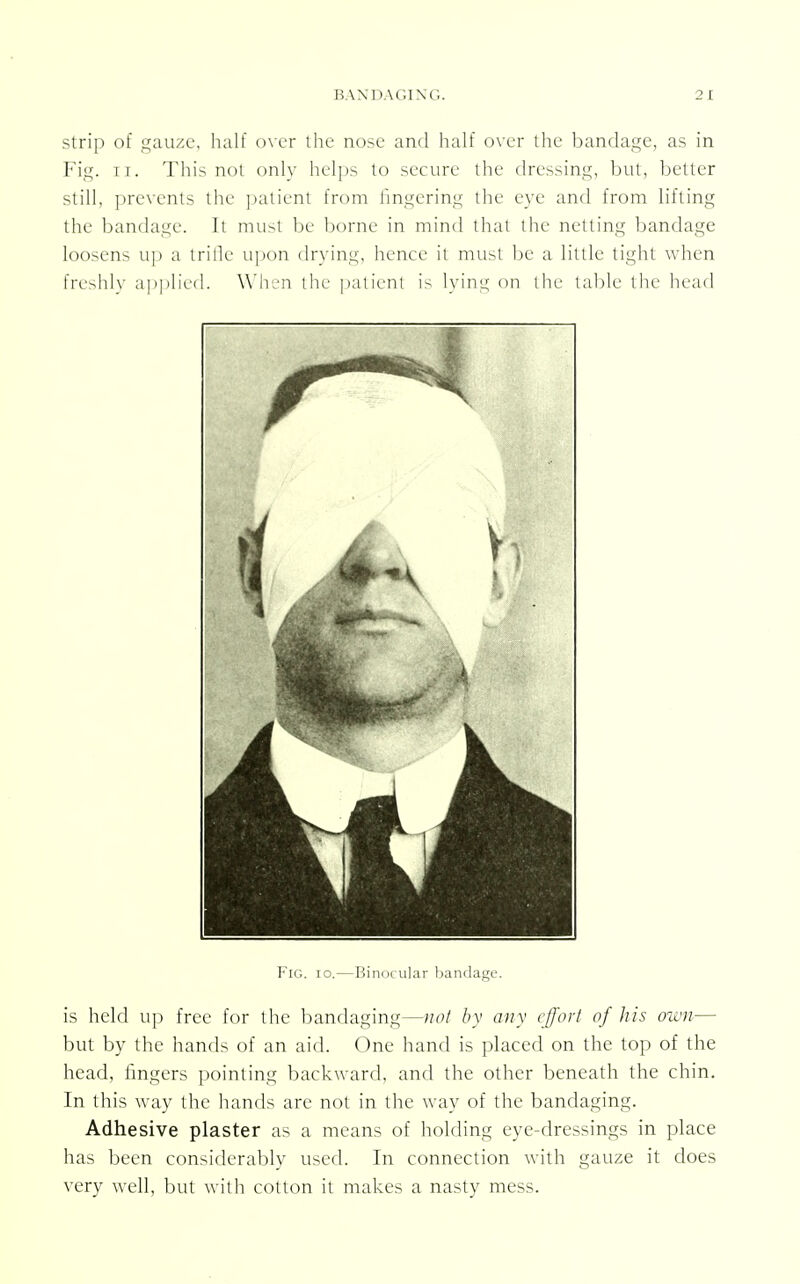 strip of gauze, half over the nose and half over the bandage, as in Fig. ii. This not only helps to secure the dressing, but, better still, prevents the patient from lingering the eye and from lifting the bandage. It must be borne in mind thai the netting bandage loosens up a trifle upon drying, hence it must be a little tight when freshly applied. When the patient is lying on the table the head Fig. io.—Binocular bandage. is held up free for the bandaging—not by any effort of his own— but by the hands of an aid. One hand is placed on the top of the head, fingers pointing backward, and the other beneath the chin. In this way the hands are not in the way of the bandaging. Adhesive plaster as a means of holding eye-dressings in place has been considerably used. In connection with gauze it does very well, but with cotton it makes a nasty mess.