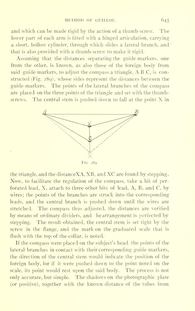 and which can be made rigid by the action of a thumb-screw. The lower part of each arm is fitted with a hinged articulation, carrying a short, hollow cylinder, through which slides a lateral branch, and that is also provided with a thumb-screw to make it rigid. Assuming that the distances separating the guide-markers, one from the other, is known, as also those of the foreign body from said guide-markers, to adjust the compass a triangle, A B C, is con- structed (Fig. 289), whose sides represent the distances between the guide-markers. The points of the lateral branches of the compass are placed on the three points of the triangle and set with the thumb- screws. The central stem is pushed down to fall at the point X in Fig. 289 the triangle, and the distanceXA, XB, and XC are found by stepping. Now, to facilitate the regulation of the compass, take a bit of per- forated lead, X, attach to three other bits of lead, A, B, and C, by wires; the points of the branches are struck into the corresponding leads, and the central branch is pushed down until the wires are stretched. The compass thus adjusted, the distances are verified by means of ordinary dividers, and he arrangement is perfected by stepping. The result obtained, the central stem is set tight by the screw in the flange, and the mark on the graduated scale that is flush with (he top of the collar, is noted. If the compass were placed on the subject's head, the points of the lateral branches in contact with their corresponding guide-markers, the direction of the central stem would indicate the position of the foreign body, for if it were pushed clown to the point noted on the scale, its point would rest upon the said body. The process is not only accurate, but simple. The shadows on the photographic plate (or positive), together with the known distance of the tubes from