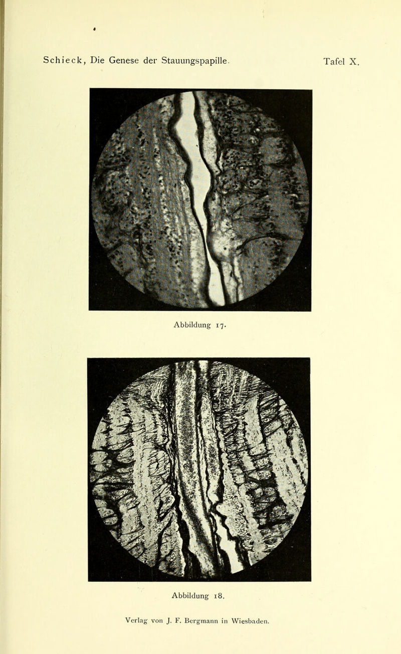# Schi eck, Die Genese der Stauungspapille. Tafel X. Abbildung 17. Abbildung 18.