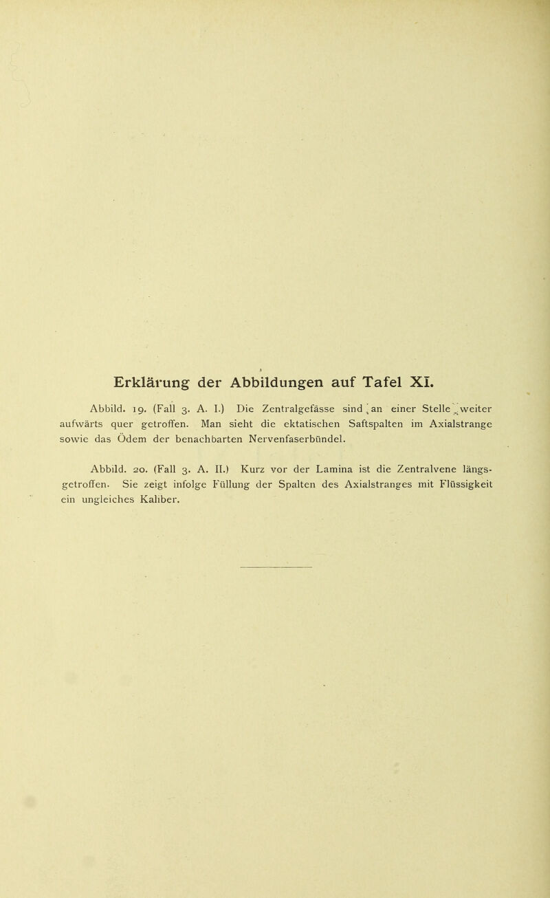 Abbild. 19. (Fall 3. A. I.) Die Zentralgefässe sind [ an einer Stelle „.weiter aufwärts quer getroffen. Man sieht die ektatischen Saftspalten im Axialstrange sowie das Ödem der benachbarten Nervenfaserbündel. Abbild. 20. (Fall 3. A. II.) Kurz vor der Lamina ist die Zentralvene längs- getroffen. Sie zeigt infolge Füllung der Spalten des Axialstranges mit Flüssigkeit ein ungleiches Kaliber.