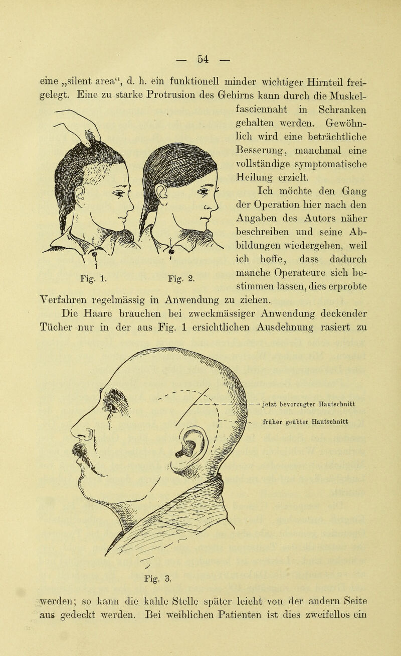 eine „silent area, d. h. ein funktionell minder wichtiger Hirnteil frei- gelegt. Eine zu starke Protrusion des Gehirns kann durch die Muskel- fasciennaht in Schranken gehalten werden. Gewöhn- lich wird eine beträchtliche Besserung, manchmal eine vollständige symptomatische Heilung erzielt. Ich möchte den Gang der Operation hier nach den Angaben des Autors näher beschreiben und seine Ab- bildungen wiedergeben, weil ich hoffe, dass dadurch manche Operateure sich be- stimmen lassen, dies erprobte Verfahren regelmässig in Anwendung zu ziehen. Die Haare brauchen bei zweckmässiger Anwendung deckender Tücher nur in der aus Fig. 1 ersichtlichen Ausdehnung rasiert zu jetzt bevorzugter Hautschnitt früher geübter Hautschnitt Fig. 3. werden; so kann die kahle Stelle später leicht von der andern Seite aus gedeckt werden. Bei weiblichen Patienten ist dies zweifellos ein