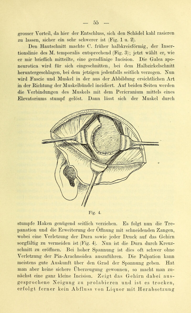 grosser Vorteil, da hier der Entschluss, sich den Schädel kahl rasieren zu lassen, sicher ein sehr schwerer ist (Fig. 1 u. 2). Den Hautschnitt machte C. früher halbkreisförmig, der Inser- tionslinie des M. temporalis entsprechend (Fig. 3); jetzt wählt er, wie er mir brieflich mitteilte, eine geradlinige Incision. Die Galea apo- neurotica wird für sich eingeschnitten, bei dem Halbzirkelschnitt heruntergeschlagen, bei dem jetzigen jedenfalls seitlich verzogen. Nun wird Fascie und Muskel in der aus der Abbildung ersichtlichen Art in der Richtung der Muskelbündel incidiert. Auf beiden Seiten werden die Verbindungen des Muskels mit dem Pericranium mittels eines Elevatoriums stumpf gelöst. Dann lässt sich der Muskel durch Fig. 4. stumpfe Haken genügend seitlich verziehen. Es folgt nun die Tre- panation und die Erweiterung der Öffnung mit schneidenden Zangen, wobei eine Verletzung der Dura sowie jeder Druck auf das Gehirn sorgfältig zu vermeiden ist (Fig. 4). Nun ist die Dura durch Kreuz- schnitt zu eröffnen. Bei hoher Spannung ist dies oft schwer ohne Verletzung der Pia-Arachnoidea auszuführen. Die Palpation kann meistens gute Auskunft über den Grad der Spannung geben. Hat man aber keine sichere Überzeugung gewonnen, so macht man zu- nächst eine ganz kleine Incision. Zeigt das Gehirn dabei aus- gesprochene Neigung zu prolabieren und ist es trocken, erfolgt ferner kein Abfluss von Liquor mit Herabsetzung