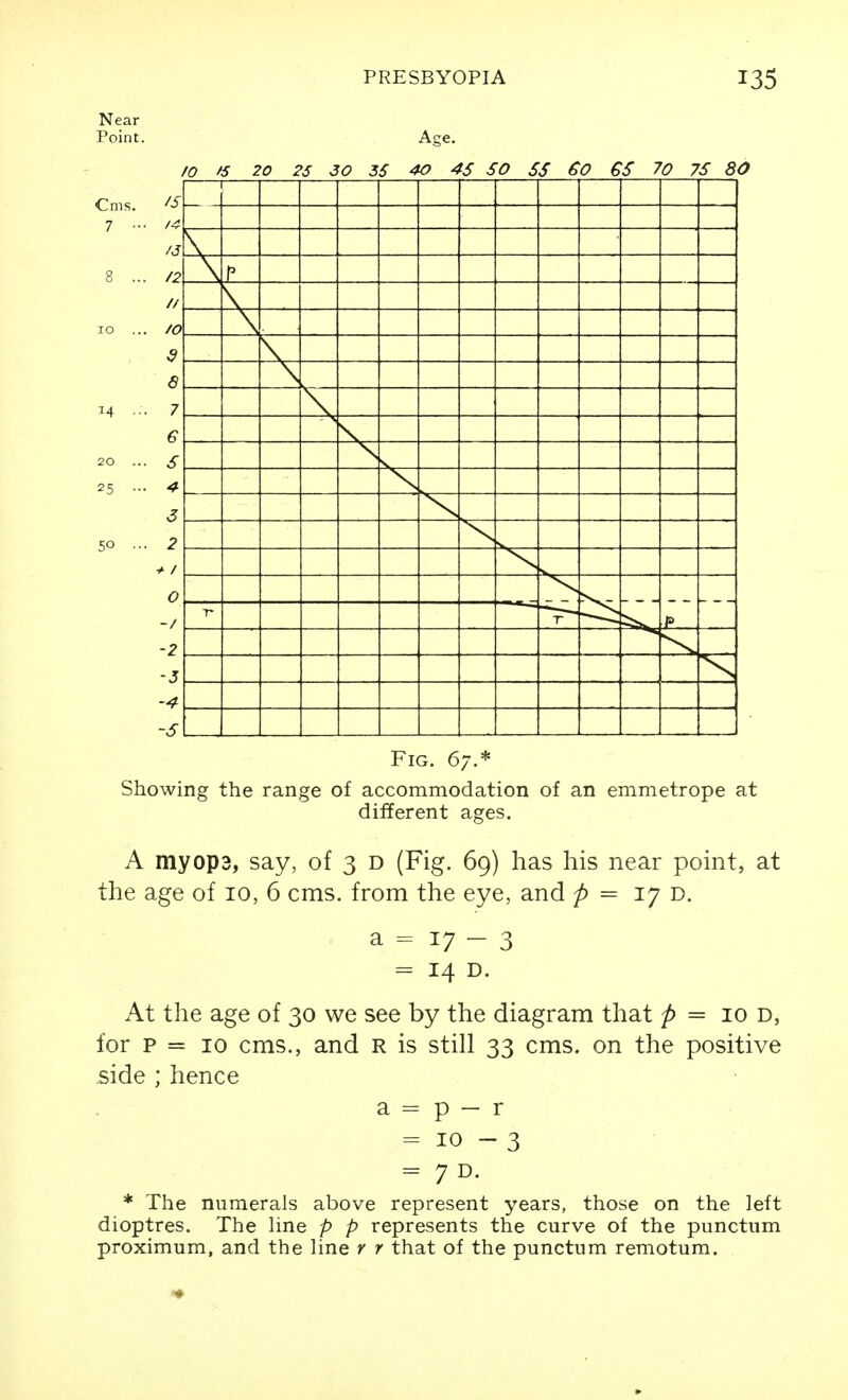 Near Point. Cms. 7 ■ Age. /O fS 20 25 3 0 5S 40 45 SO SS GS 70 7S 80 V \ r V \ \ \ T- Fig. 67.* Showing the range of accommodation of an emmetrope at different ages. A myop3, say, of 3 d (Fig. 69) has his near point, at the age of 10, 6 cms. from the eye, and p = 17 D. a = 17 - 3 = 14 D. At the age of 30 we see by the diagram that p = 10 d, for p = 10 cms., and R is still 33 cms. on the positive side ; hence a = p — r = 10-3 = 7 D. * The numerals above represent years, those on the left dioptres. The line p p represents the curve of the punctum proximum, and the line y r that of the punctum remotum.