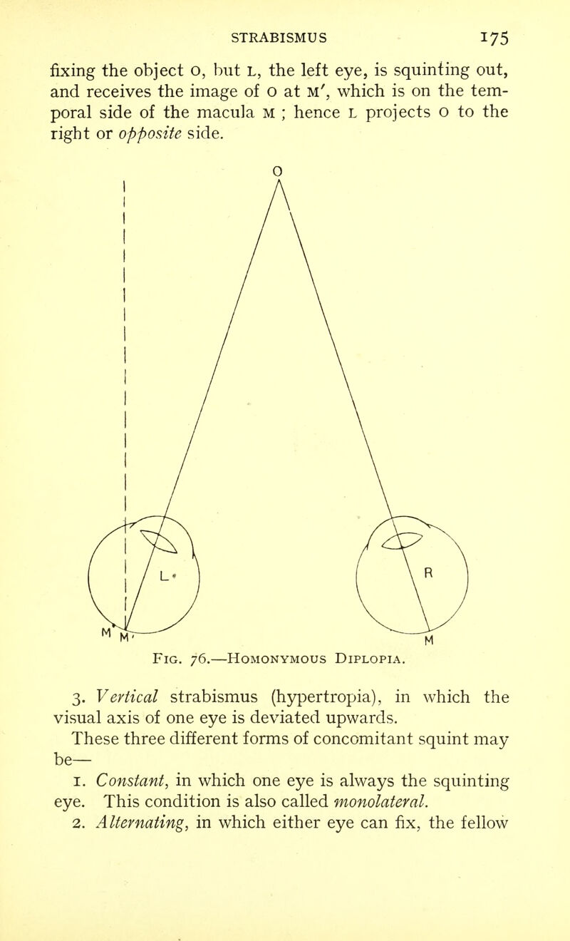 fixing the object o, but L, the left eye, is squinting out, and receives the image of o at m', which is on the tem- poral side of the macula m ; hence L projects o to the right or opposite side. 0 Fig. 76.—Homonymous Diplopia. 3. Vertical strabismus (hypertropia), in which the visual axis of one eye is deviated upwards. These three different forms of concomitant squint may- be— 1. Constant, in which one eye is always the squinting eye. This condition is also called monolateral. 2. Alternating, in which either eye can fix, the fellow