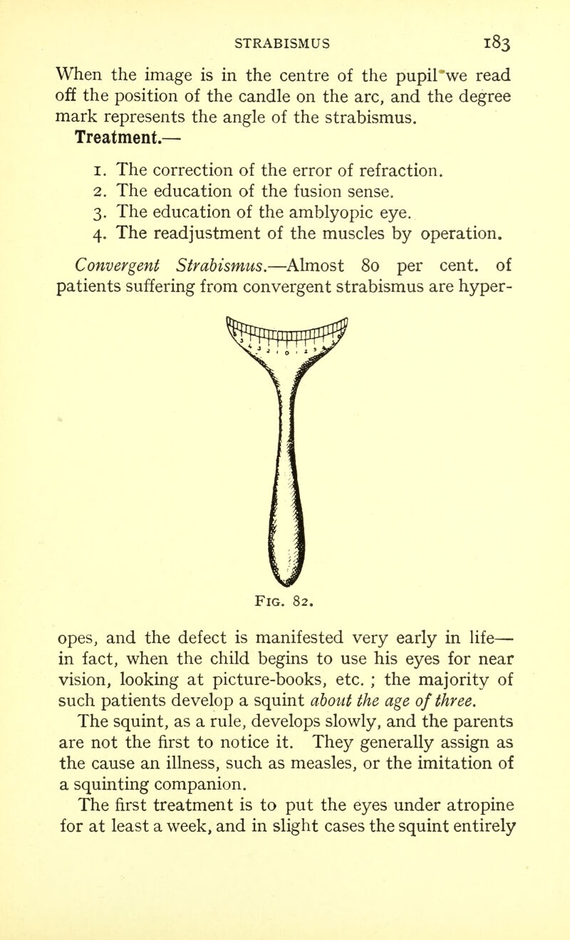 When the image is in the centre of the pupil'we read off the position of the candle on the arc, and the degree mark represents the angle of the strabismus. Treatment.— 1. The correction of the error of refraction. 2. The education of the fusion sense. 3. The education of the amblyopic eye. 4. The readjustment of the muscles by operation. Convergent Strabismus.—^Almost 80 per cent, of patients suffering from convergent strabismus are hyper- opes, and the defect is manifested very early in life— in fact, when the child begins to use his eyes for near vision, looking at picture-books, etc. ; the majority of such patients develop a squint abo^tt the age of three. The squint, as a rule, develops slowly, and the parents are not the first to notice it. They generally assign as the cause an illness, such as measles, or the imitation of a squinting companion. The first treatment is to put the eyes under atropine for at least a week, and in slight cases the squint entirely Fig. 82.