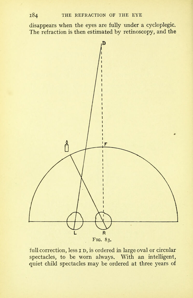 disappears when the eyes are fully under a cycloplegic. The refraction is then estimated by retinoscopy, and the L R Fig. 83. full correction, less i D, is ordered in large oval or circular spectacles, to be worn always. With an inteUigent, quiet child spectacles may be ordered at three years of