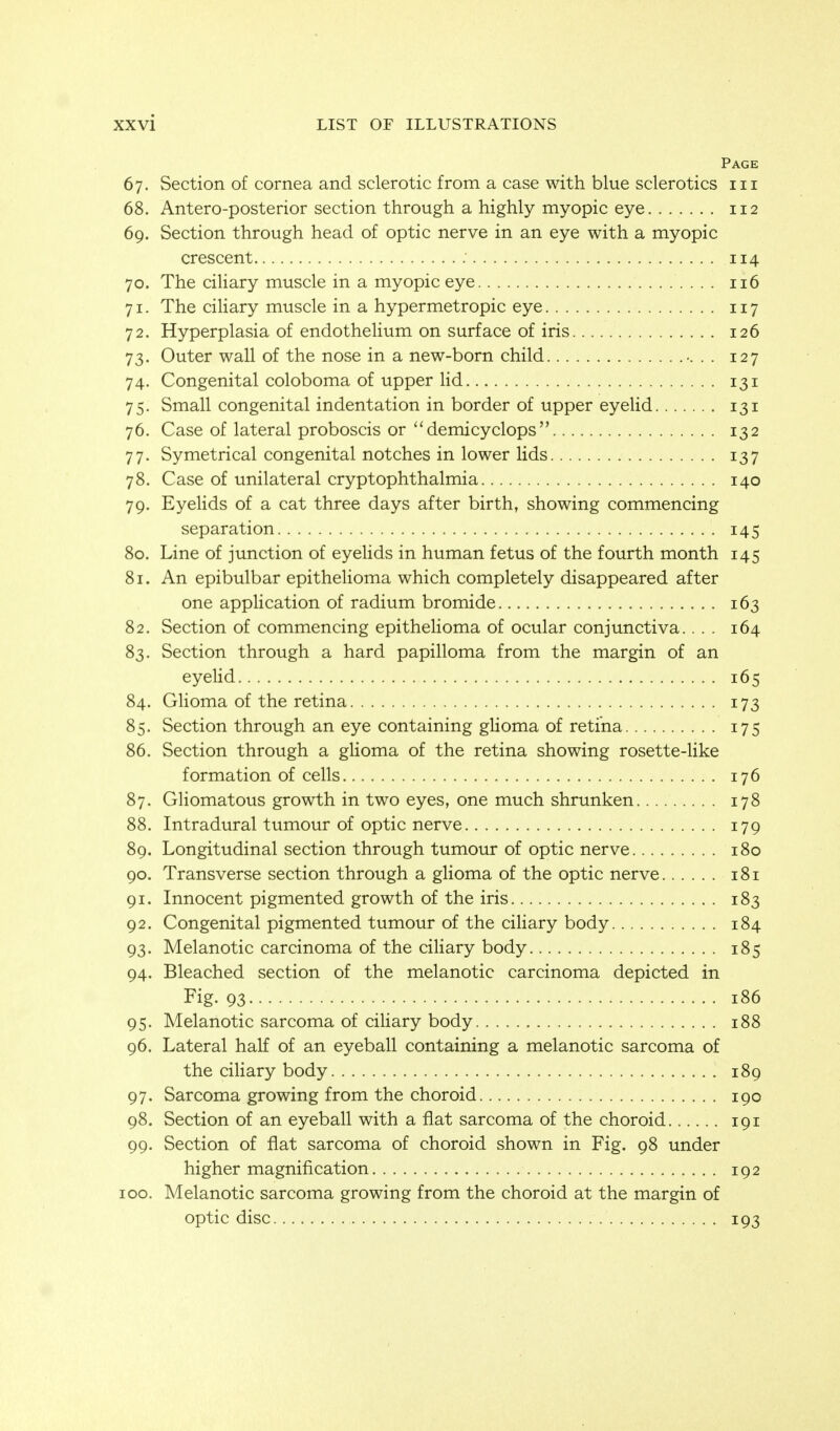 Page 67. Section of cornea and sclerotic from a case with blue sclerotics iii 68. Antero-posterior section through a highly myopic eye 112 69. Section through head of optic nerve in an eye with a myopic crescent 114 70. The ciliary muscle in a myopic eye 116 71. The ciliary muscle in a hypermetropic eye 117 72. Hyperplasia of endothelium on surface of iris 126 73. Outer wall of the nose in a new-born child . . 127 74. Congenital coloboma of upper Hd 131 75. Small congenital indentation in border of upper eyelid 131 76. Case of lateral proboscis or ''demicyclops 132 77. Symetrical congenital notches in lower lids 137 78. Case of unilateral cryptophthalmia 140 79. EyeHds of a cat three days after birth, showing commencing separation 145 80. Line of junction of eyelids in human fetus of the fourth month 145 81. An epibulbar epithelioma which completely disappeared after one appHcation of radium bromide 163 82. Section of commencing epithelioma of ocular conjunctiva.... 164 83. Section through a hard papilloma from the margin of an eyelid 165 84. Glioma of the retina 173 85. Section through an eye containing glioma of retina 175 86. Section through a glioma of the retina showing rosette-like formation of cells 176 87. Gliomatous growth in two eyes, one much shrunken 178 88. Intradural tumour of optic nerve 179 89. Longitudinal section through tumour of optic nerve 180 90. Transverse section through a glioma of the optic nerve 181 91. Innocent pigmented growth of the iris 183 92. Congenital pigmented tumour of the ciHary body 184 93. Melanotic carcinoma of the ciliary body 185 94. Bleached section of the melanotic carcinoma depicted in Fig. 93 186 95. Melanotic sarcoma of ciHary body 188 96. Lateral half of an eyeball containing a melanotic sarcoma of the ciliary body 189 97. Sarcoma growing from the choroid 190 98. Section of an eyeball with a flat sarcoma of the choroid 191 99. Section of flat sarcoma of choroid shown in Fig. 98 under higher magnification 192 100. Melanotic sarcoma growing from the choroid at the margin of optic disc 193