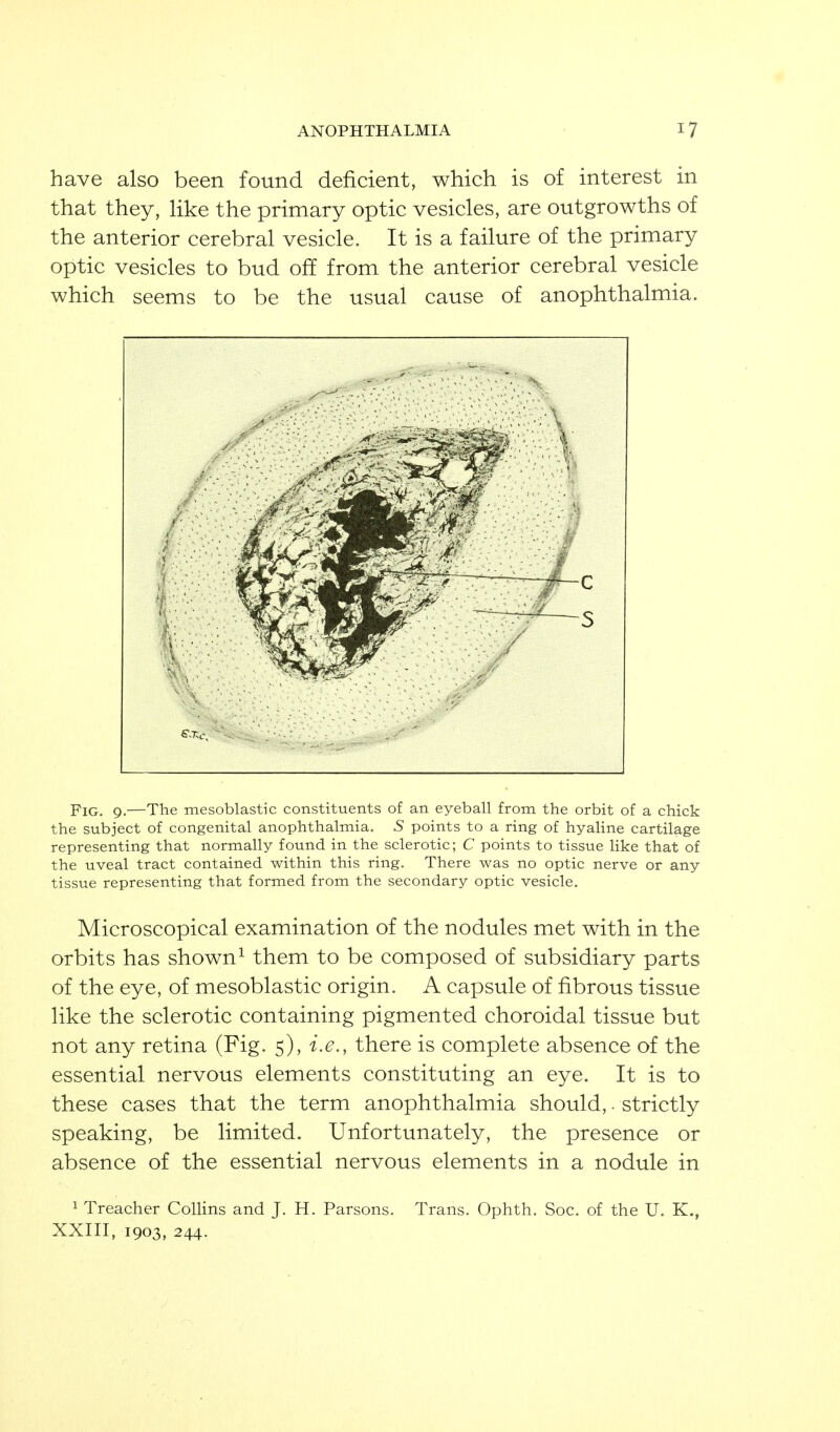 have also been found deficient, which is of interest in that they, hke the primary optic vesicles, are outgrowths of the anterior cerebral vesicle. It is a failure of the primary optic vesicles to bud off from the anterior cerebral vesicle which seems to be the usual cause of anophthalmia. Fig. 9.—The mesoblastic constituents of an eyeball from the orbit of a chick the subject of congenital anophthalmia. 5 points to a ring of hyaline cartilage representing that normally found in the sclerotic; C points to tissue like that of the uveal tract contained within this ring. There was no optic nerve or any tissue representing that formed from the secondary optic vesicle. Microscopical examination of the nodules met with in the orbits has shown ^ them to be composed of subsidiary parts of the eye, of mesoblastic origin. A capsule of fibrous tissue like the sclerotic containing pigmented choroidal tissue but not any retina (Fig. 5), i.e., there is complete absence of the essential nervous elements constituting an eye. It is to these cases that the term anophthalmia should,. strictly speaking, be limited. Unfortunately, the presence or absence of the essential nervous elements in a nodule in 1 Treacher ColHns and J. H. Parsons. Trans. Ophth. Soc. of the U. K., XXIII, 1903, 244.