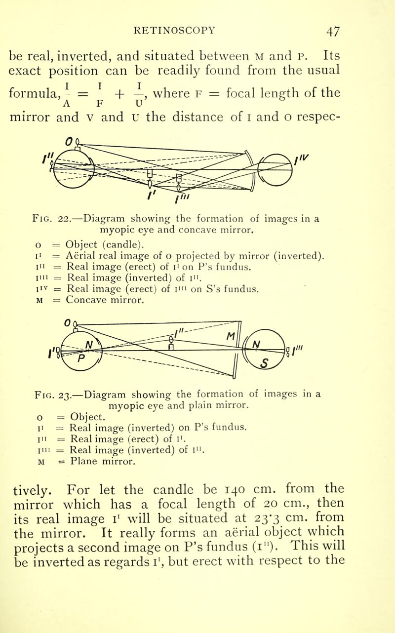 be real, inverted, and situated between m and p. Its exact position can be readily found from the usual formula,1 = 1 + —. where F = focal length of the A F u mirror and v and u the distance of i and o respec- Fig. 22.—Diagram showing the formation of images in a myopic eye and concave mirror. o = Object (candle). i1 = Aerial real image of o projected by mirror (inverted). in = Real image (erect) of I1 on P's fundus. ini = Real image (inverted) of i». I1V = Real image (erect) of I111 on S's fundus. m = Concave mirror. Fig. 23.—Diagram showing the formation of images in a myopic eye and plain mirror. o = Object. 11 = Real image (inverted) on P's fundus, in = Real image (erect) of I1. ITU = Real image (inverted) of I. M = Plane mirror. tively. For let the candle be 140 cm. from the mirror which has a focal length of 20 cm., then its real image I1 will be situated at 23*3 cm. from the mirror. It really forms an aerial object which projects a second image on P's fundus (1). This will be inverted as regards I1, but erect with respect to the