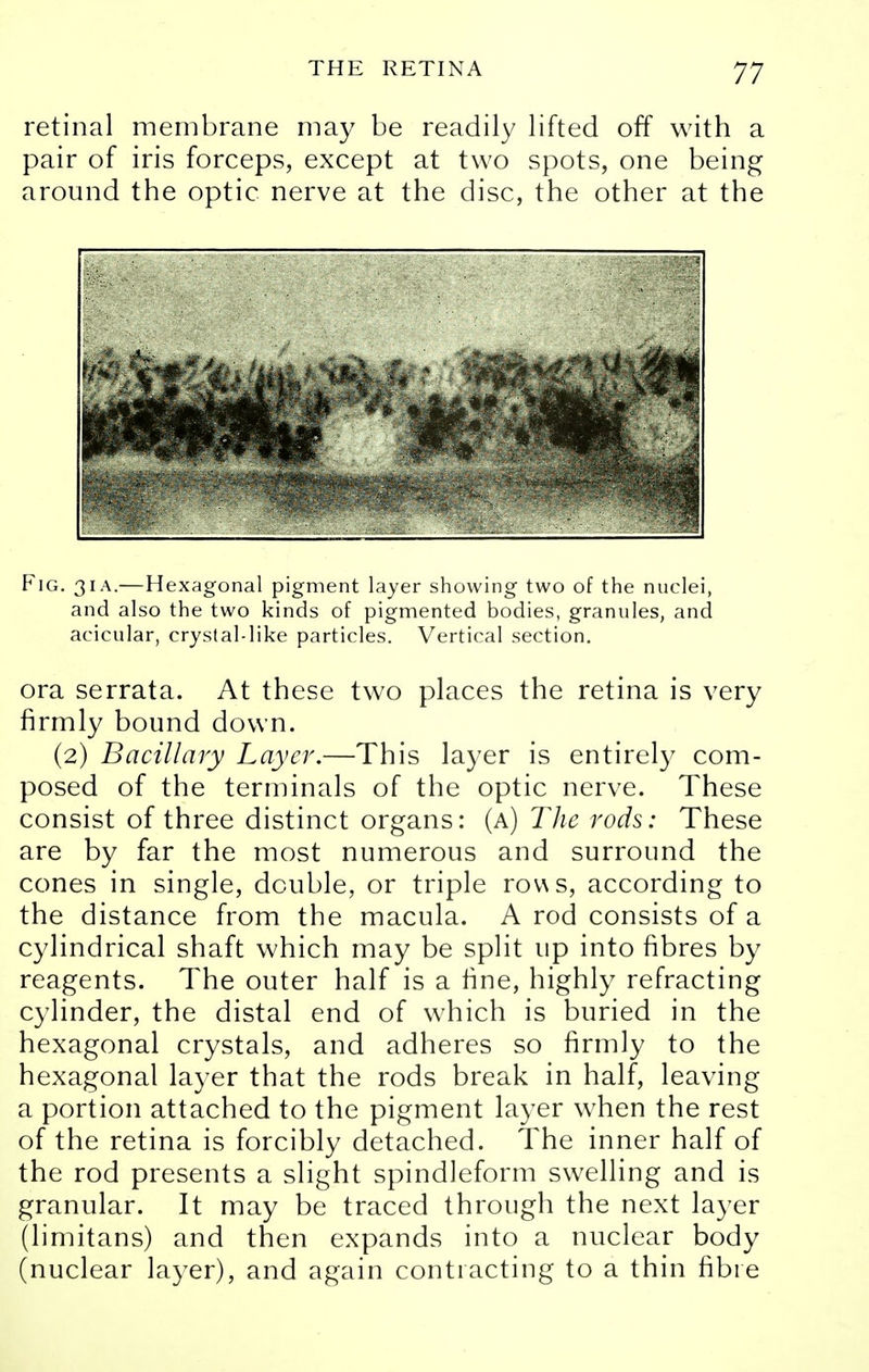 retinal membrane may be readily lifted off with a pair of iris forceps, except at two spots, one being around the optic nerve at the disc, the other at the Fig. 3i a.—Hexagonal pigment layer showing two of the nuclei, and also the two kinds of pigmented bodies, granules, and acicular, crystal-like particles. Vertical section. ora serrata. At these two places the retina is very firmly bound down. (2) Bacillary Layer.—This layer is entirely com- posed of the terminals of the optic nerve. These consist of three distinct organs: (a) The rods: These are by far the most numerous and surround the cones in single, double, or triple rov\s, according to the distance from the macula. A rod consists of a cylindrical shaft which may be split up into fibres by reagents. The outer half is a fine, highly refracting cylinder, the distal end of which is buried in the hexagonal crystals, and adheres so firmly to the hexagonal layer that the rods break in half, leaving a portion attached to the pigment layer when the rest of the retina is forcibly detached. The inner half of the rod presents a slight spindleform swelling and is granular. It may be traced through the next layer (limitans) and then expands into a nuclear body (nuclear layer), and again contracting to a thin fibre