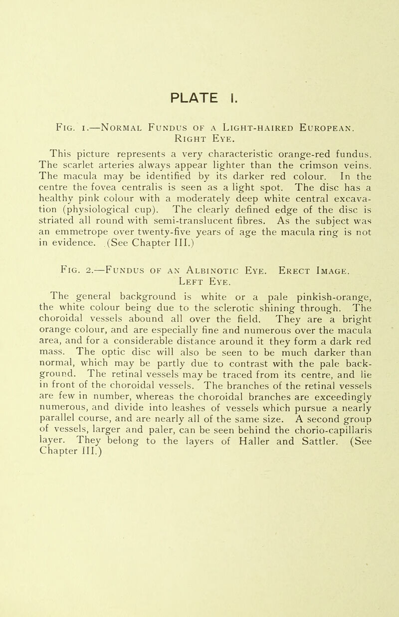 Fig. i.—Normal Fundus of a Light-haired European. Right Eye. This picture represents a very characteristic orange-red fundus. The scarlet arteries always appear lighter than the crimson veins. The macula may be identified by its darker red colour. In the centre the fovea centralis is seen as a light spot. The disc has a healthy pink colour with a moderately deep white central excava- tion (physiological cup). The clearly defined edge of the disc is striated all round with semi-translucent fibres. As the subject was an emmetrope over twenty-five years of age the macula ring is not in evidence. (See Chapter III.) Fig. 2.—Fundus of an Albinotic Eye. Erect Image. Left Eye. The general background is white or a pale pinkish-orange, the white colour being due to the sclerotic shining through. The choroidal vessels abound all over the field. They are a bright orange colour, and are especially fine and numerous over the macula area, and for a considerable distance around it they form a dark red mass. The optic disc will also be seen to be much darker than normal, which may be partly due to contrast with the pale back- ground. The retinal vessels may be traced from its centre, and lie in front of the choroidal vessels. The branches of the retinal vessels are few in number, whereas the choroidal branches are exceedingly numerous, and divide into leashes of vessels which pursue a nearly parallel course, and are nearly all of the same size. A second group of vessels, larger and paler, can be seen behind the chorio-capillaris layer. They belong to the layers of Haller and Sattler. (See Chapter III.)