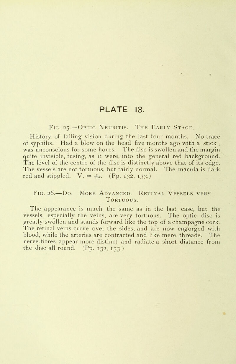Fig. 25.—Optic Neuritis. The Early Stage. History of failing vision during the last four months. No trace of syphilis. Had a blow on the head five months ago with a stick ; was unconscious for some hours. The disc is swollen and the margin quite invisible, fusing, as it were, into the general red background. The level of the centre of the disc is distinctly above that of its edge. The vessels are not tortuous, but fairly normal. The macula is dark red and stippled. V. = T\-. (Pp. 132, 133.) Fig. 26.—Do. More Advanced. Retinal Vessels very Tortuous. The appearance is much the same as in the last case, but the vessels, especially the veins, are very tortuous. The optic disc is greatly swollen and stands forward like the top of a champagne cork. The retinal veins curve over the sides, and are now engorged with blood, while the arteries are contracted and like mere threads. The nerve-fibres appear more distinct and radiate a short distance from