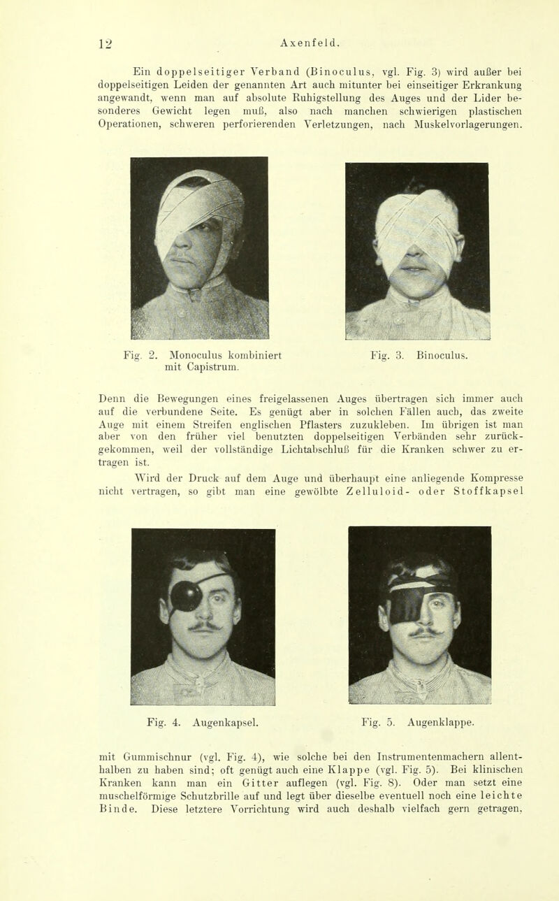 Ein doppelseitiger Verband (Binoculus, vgl. Fig. 3) wird außer bei doppelseitigen Leiden der genannten Art auch mitunter bei einseitiger Erkrankung angewandt, wenn man auf absolute Ruhigstellung des Auges und der Lider be- sonderes Gewicht legen muß, also nach manchen schwierigen plastischen Operationen, schweren perforierenden Verletzungen, nach Muskel Verlagerungen. Fig. 2. Monoculus kombiniert Fig. 3. Binoculus. mit Capistrum. Denn die Bewegungen eines freigelassenen Auges übertragen sich immer auch auf die verbundene Seite. Es genügt aber in solchen Fällen auch, das zweite Auge mit einem Streifen englischen Pflasters zuzukleben. Im übrigen ist man aber von den früher viel benutzten doppelseitigen Verbänden sehr zurück- gekommen, weil der vollständige Lichtabschluß für die Kranken schwer zu er- tragen ist. Wird der Druck auf dem Auge und überhaupt eine anliegende Kompresse nicht vertragen, so gibt man eine gewölbte Zelluloid- oder Stoffkapsel Fig. 4. Augenkajisel. Fig. 5. Augenklappe. mit Gummischnur (vgl. Fig. 4), wie solche bei den Listrumentenmachern allent- halben zu haben sind; oft genügtauch eine Klappe (vgl. Fig. 5). Bei klinischen Kranken kann man ein Gitter auflegen (vgl. Fig. 8). Oder man setzt eine muschelförmige Schutzbrille auf und legt über dieselbe eventuell noch eine leichte Binde. Diese letztere Vorrichtung wird auch deshalb vielfach gern getragen.