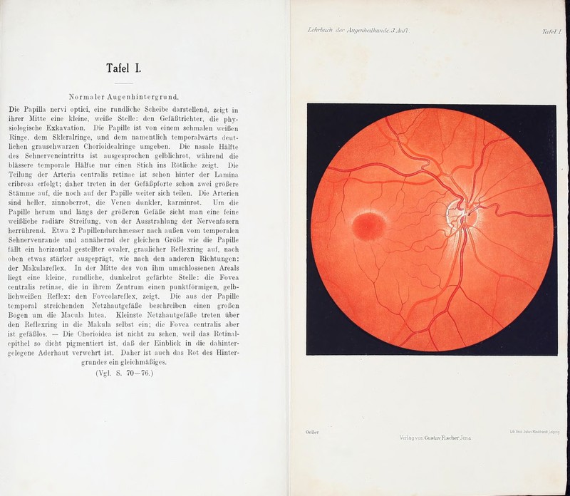 Normaler Augenliintergrund. Die Papilla nervi optici, eine rundUche Scheibe darstellend, zeigt in ihrer Mitte eine kleine, weiße Stelle: den Gefäßtrichter, die phy- siologische Exkavation. Die Papille ist von einem schmalen weißen Ringe, dem Skleralringe, und dem namentlich temporalwärts deut- lichen grauschwarzen Chorioidealringe umgeben. Die nasa.le Hälfte des Sehnerveneintritts ist ausgesprochen gelbhchrot, während die blassere temporale Häüie nur einen Stich ins Rötliche zeigt. Die Teilung der Arteria centrahs retinae ist schon hinter der Lamina cribrosa erfolgt; daher treten in der Gefäßpforte schon zwei größere Stämme auf, die noch auf der Papille weiter sich teilen. Die Arterien sind heller, zinnoberrot, die Venen dunkler, karminrot. Um die Papille herum und längs der größeren Gefäße sieht man eine feine weißliche radiäre Streifung, von der Ausstrahlung der Nervenfasern herrührend. Etwa 2 PapiUendurchmesser nach außen vom temporalen Sehnervenrande und annähernd der gleichen Größe wie die Papille fällt ein horizontal gestellter ovaler, graulicher Reflexring auf, nach oben etwas stärker ausgeprägt, wie nach den anderen Richtungen: der Makulareflex. In der Mitte des von ihm umschlossenen Areals liegt eine kleine, rundliche, dunkelrot gefärbte Stelle: die Fovea centralis retinae, die in ihrem Zentrum einen punktförmigen, gelb- lichweißen Reflex: den Foveolareflex, zeigt. Die aus der Papille temporal streichenden Netzhautgefäße beschreiben einen großen Bogen um die Macula lutea. Kleinste. Netzhautgefäße treten über den Reflexring in die Makula selbst ein; die Fovea centralis aber ist gefäßlos. - Die Chorioidea ist nicht zu sehen, weil das Retinal- epithel so dicht pigmentiert ist, daß der Einblick in die dahinter- gelegene Aderhaut verwehrt ist. Daher ist auch das Rot des Hinter- grundes ein gleichmäßiges. (Vgl. S. 70-76.) Lehrhuch da- Aniieiütalkimde.S.Aiin. Verlag von Gustav Fischer, Jena-