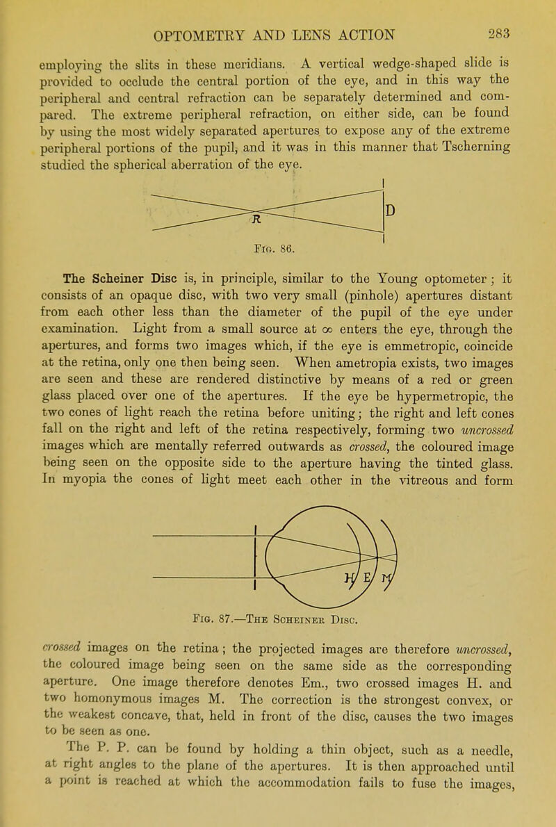 employing the slits in these meridians. A vertical wedge-shaped slide is provided to occlude the central portion of the eye, and in this way the peripheral and central refraction can be separately determined and com- pared. The extreme peripheral refraction, on either side, can be found by using the most widely separated apertures to expose any of the extreme peripheral portions of the pupil, and it was in this manner that Tscherning studied the spherical aberration of the eye. Fig. 86. The Scheiner Disc is, in principle, similar to the Young optometer; it consists of an opaque disc, with two very small (pinhole) apertures distant from each other less than the diameter of the pupil of the eye under examination. Light from a small source at oo enters the eye, through the apertures, and forms two images which, if the eye is emmetropic, coincide at the retina, only one then being seen. When ametropia exists, two images are seen and these are rendered distinctive by means of a red or green glass placed over one of the apertures. If the eye be hypermetropic, the two cones of light reach the retina before uniting; the right and left cones fall on the right and left of the retina respectively, forming two uncrossed images which are mentally referred outwards as crossed, the coloured image being seen on the opposite side to the aperture having the tinted glass. In myopia the cones of light meet each other in the vitreous and form Fig. 87.—The Scheiner Disc. crossed images on the retina; the projected images are therefore uncrossed, the coloured image being seen on the same side as the corresponding aperture. One image therefore denotes Em., two crossed images H. and two homonymous images M. The correction is the strongest convex, or the weakest concave, that, held in front of the disc, causes the two images to be seen as one. The P. P. can be found by holding a thin object, such as a needle, at right angles to the plane of the apertures. It is then approached until a point is reached at which the accommodation fails to fuse the images,