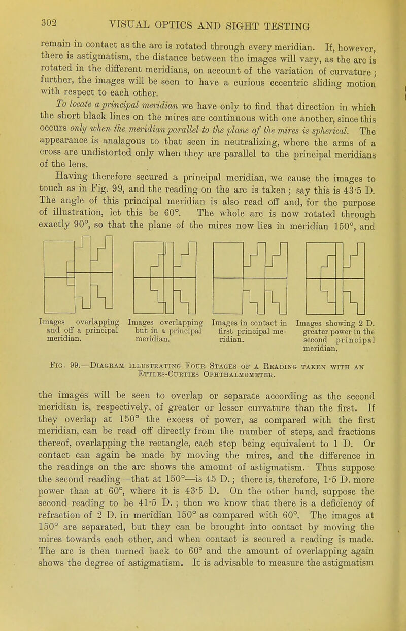 remain in contact as the arc is rotated through every meridian. If, however, there is astigmatism, the distance between the images will vary, as the arc is rotated in the different meridians, on account of the variation of curvature ; further, the images will be seen to have a curious eccentric sliding motion with respect to each other. To locate a principal meridian we have only to find that direction in which the short black lines on the mires are continuous with one another, since this occurs only when the meridian parallel to the plane of the mires is spherical. The appearance is analagous to that seen in neutralizing, where the arms of a cross are undistorted only when they are parallel to the principal meridians of the lens. Having therefore secured a principal meridian, we cause the images to touch as in Fig. 99, and the reading on the arc is taken; say this is 43-5 D. The angle of this principal meridian is also read off and, for the purpose of illustration, let this be 60°. The whole arc is now rotated through exactly 90°, so that the plane of the mires now lies in meridian 150°, and Images overlapping Images overlapping Images in contact in Images showing 2 D. and off a principal but in a principal first principal me- greater power in the meridian. meridian. ridian. second principal meridian. Fig. 99.—Diagram illustrating Four Stages of a Reading taken with an Ettles-Citrties Ophthalmometer. the images will be seen to overlap or separate according as the second meridian is, respectively, of greater or lesser curvature than the first. If they overlap at 150° the excess of power, as compared with the first meridian, can be read off directly from the number of steps, and fractions thereof, overlapping the rectangle, each step being equivalent to 1 D. Or contact can again be made by moving the mires, and the difference in the readings on the arc shows the amount of astigmatism. Thus suppose the second reading—that at 150°—is 45 D.; there is, therefore, 1-5 D. more power than at 60°, where it is 43*5 D. On the other hand, suppose the second reading to be 41*5 D. ; then we know that there is a deficiency of refraction of 2 D. in meridian 150° as compared with 60°. The images at 150° are separated, but they can be brought into contact by moving the mires towards each other, and when contact is secured a reading is made. The arc is then turned back to 60° and the amount of overlapping again shows the degree of astigmatism. It is advisable to measure the astigmatism