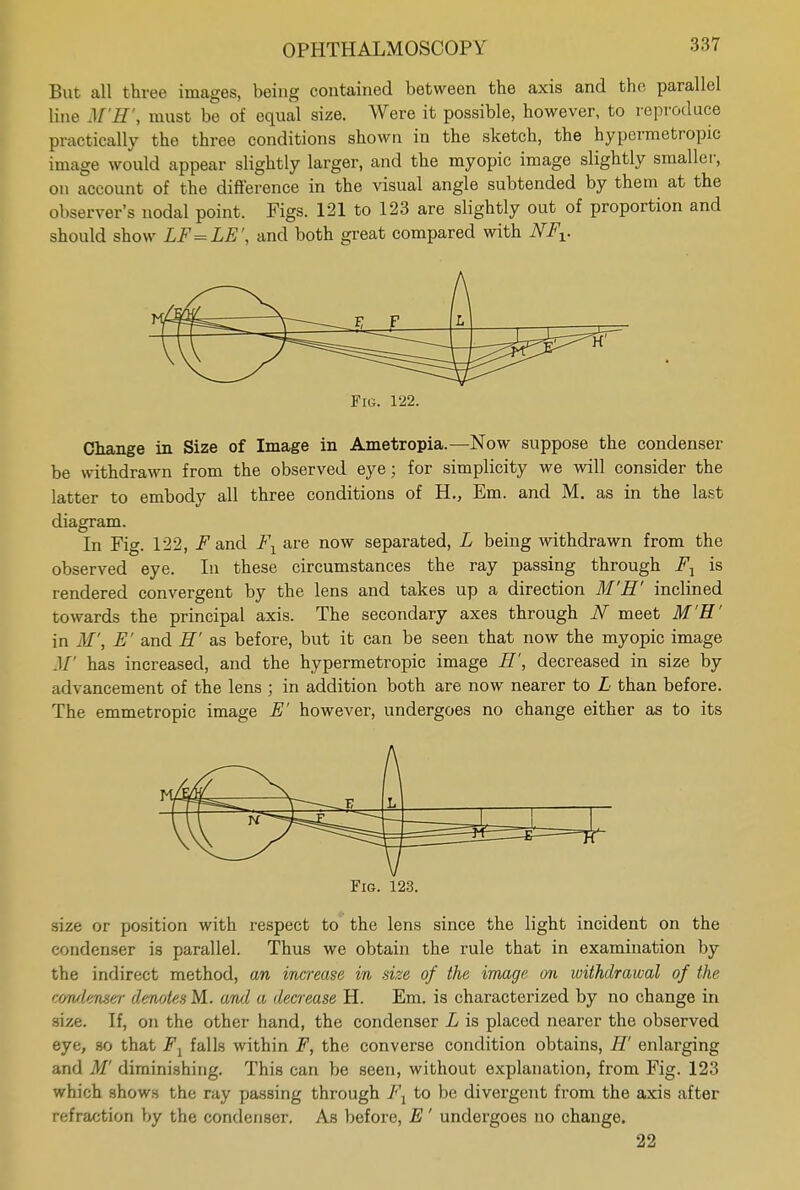 But all three images, being contained between the axis and the parallel line M'H', must be of equal size. Were it possible, however, to reproduce practically the three conditions shown in the sketch, the hypermetropic image would appear slightly larger, and the myopic image slightly smaller, on account of the difference in the visual angle subtended by them at the observer's nodal point. Figs. 121 to 123 are slightly out of proportion and should show LF=LE', and both great compared with NFV Fig. 122. Change in Size of Image in Ametropia.—Now suppose the condenser be withdrawn from the observed eye; for simplicity we will consider the latter to embody all three conditions of H., Em. and M. as in the last diagram. In Fig. 122, .Fand F1 are now separated, L being withdrawn from the observed eye. In these circumstances the ray passing through FA is rendered convergent by the lens and takes up a direction M'H' inclined towards the principal axis. The secondary axes through N meet M'H' in M', E' and H' as before, but it can be seen that now the myopic image .1/' has increased, and the hypermetropic image H', decreased in size by advancement of the lens ; in addition both are now nearer to L than before. The emmetropic image E' however, undergoes no change either as to its Fig. 123. size or position with respect to the lens since the light incident on the condenser is parallel. Thus we obtain the rule that in examination by the indirect method, an increase in size of the image on withdrawal of the condenser denotes M. and a decrease H. Em. is characterized by no change in size. If, on the other hand, the condenser L is placed nearer the observed eye, so that Fx falls within F, the converse condition obtains, H' enlarging and M diminishing. This can be seen, without explanation, from Fig. 123 which shows the ray passing through F1 to be divergent from the axis after refraction by the condenser. As before, E' undergoes no change. 22