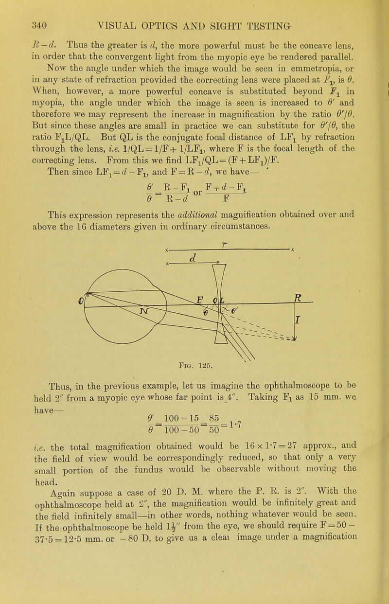 R — d. Thus the greater is d, the more powerful must be the concave lens, in order that the convergent light from the myopic eye be rendered parallel. Now the angle under which the image would be seen in emmetropia, or in any state of refraction provided the correcting lens were placed at Fv is 8. When, however, a more powerful concave is substituted beyond F1 in myopia, the angle under which the image is seen is increased to 8' and therefore we may represent the increase in magnification by the ratio 8'/6. But since these angles are small in practice we can substitute for 8'/8, the ratio FjL/QL. But QL is the conjugate focal distance of LFX by refraction through the lens, i.e. 1/QL = 1/F+ 1/LF^ where F is the focal length of the correcting lens. From this we find LFX/QL = (F + LF1)/F. Then since LF, = d - F v and F = R - d, we have- 8' R-F, F + d-F, 8 F This expression represents the additional magnification obtained over and above the 16 diameters given in ordinary circumstances. \7 R ^9 I i Fig. 125. Thus, in the previous example, let us imagine the ophthalmoscope to be held 2 from a myopic eye whose far point is 4. Taking Fj as 15 mm. we have— fl'_100-15_85 0~1OO-5O_5O i.e. the total magnification obtained would be 16x1-7 = 27 approx., and the field of view would be correspondingly reduced, so that only a very small portion of the fundus would be observable without moving the head. Again suppose a case of 20 D. M. where the P. R. is 2. With the ophthalmoscope held at 2, the magnification would be infinitely great and the field infinitely small—in other words, nothing whatever would be seen. If the ophthalmoscope be held l£ from the eye, we should require F = 50 - 37-5 = 12-5 mm. or -80 D. to give us a cleai image under a magnification