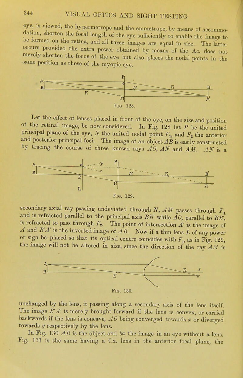 eye, is viewed, the hypermetrope and the emmetrope, by means of accommo- dation, shorten the focal length of the eye sufficiently to enable the image to be formed on the retina, and all three images are equal in size. The latter occurs provided the extra power obtained by means of the Ac. does not merely shorten the focus of the eye but also places the nodal points in the same position as those of the myopic eye. Let the effect of lenses placed in front of the eye, on the size and position of the retinal image, be now considered. In Fig. 128 let P be the united principal plane of the eye, N the united nodal point Fv and F2 the anterior and posterior principal foci. The image of an object AB is easily constructed by tracing the course of three known rays AO, AN and AM. AN is a secondary axial ray passing undeviated through N, AM passes through Fl and is refracted parallel to the principal axis BB' while AO, parallel to BB', is refracted to pass through F2. The point of intersection A' is the image of A and B'A' is the inverted image of AB. Now if a thin lens L of any power or sign be placed so that its optical centre coincides with Fv as in Fig. 129, the image will not be altered in size, since the direction of the ray AM is Fig. 130. unchanged by the lens, it passing along a secondary axis of the lens itself. The image B'A' is merely brought forward if the lens is convex, or carried backwards if the lens is concave, AO being converged towards x or diverged towards y respectively by the lens. In Fig. 130 AB is the object and ba the image in an eye without a lens. Fig. 131 is the same having a Cx. lens in the anterior focal plane, the