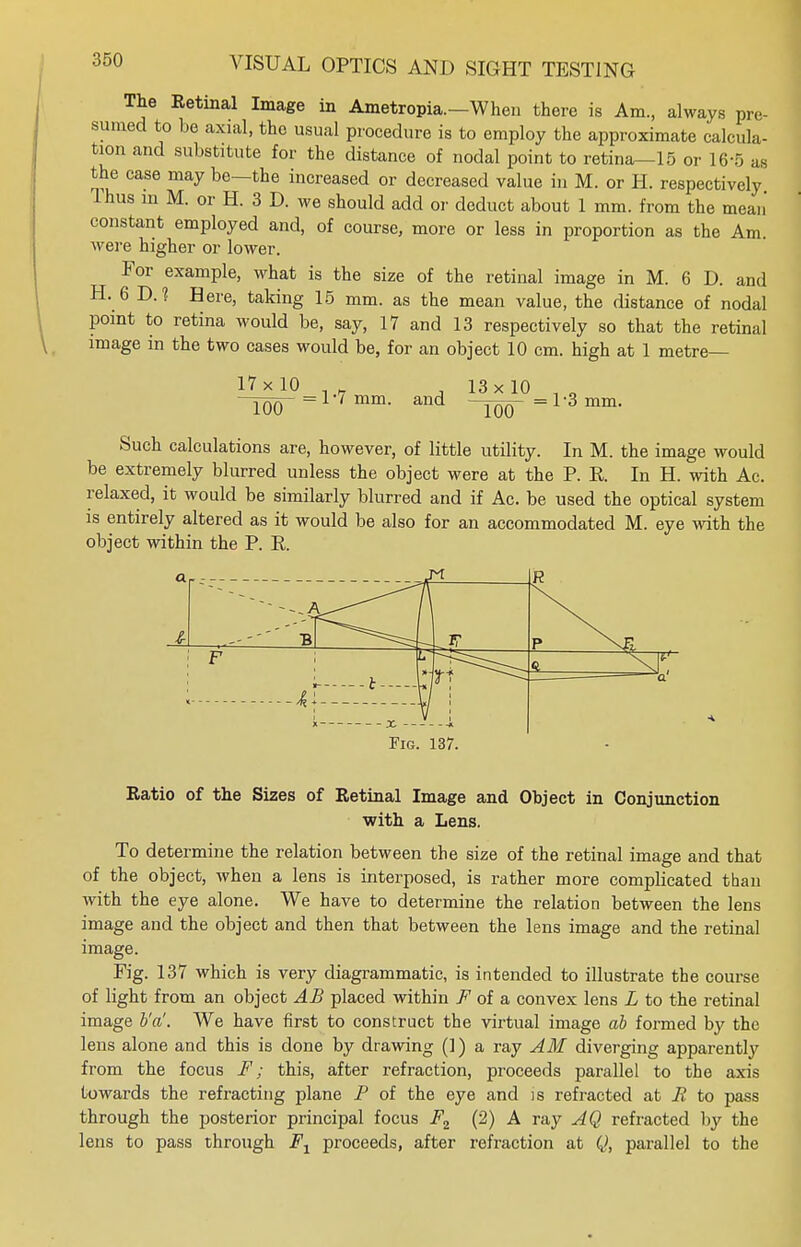 The Eetmal Image in Ametropia.—When there is Am., always pre- sumed to be axial, the usual procedure is to employ the approximate calcula- tion and substitute for the distance of nodal point to retina—15 or 16-5 as the case may be—the increased or decreased value in M. or H. respectively Thus in M. or H. 3 D. we should add or deduct about 1 mm. from the mean constant employed and, of course, more or less in proportion as the Am. were higher or lower. For example, what is the size of the retinal image in M. 6 D. and H. 6 D.1 Here, taking 15 mm. as the mean value, the distance of nodal point to retina would be, say, 17 and 13 respectively so that the retinal image in the two cases would be, for an object 10 cm. high at 1 metre— 17 x 10 100 = 1*7 mm. and 13 x 10 100 = 1*3 mm. Such calculations are, however, of little utility. In M. the image would be extremely blurred unless the object were at the P. R. In H. with Ac. relaxed, it would be similarly blurred and if Ac. be used the optical system is entirely altered as it would be also for an accommodated M. eye with the object within the P. R. 1R X ■* Fig. 137. Eatio of the Sizes of Eetinal Image and Object in Conjunction with a Lens. To determine the relation between the size of the retinal image and that of the object, when a lens is interposed, is rather more complicated than with the eye alone. We have to determine the relation between the lens image and the object and then that between the lens image and the retinal image. Fig. 137 which is very diagrammatic, is intended to illustrate the course of light from an object AB placed within F of a convex lens L to the retinal image b'a'. We have first to construct the virtual image ab formed by the lens alone and this is done by drawing (1) a ray AM diverging apparently from the focus F; this, after refraction, proceeds parallel to the axis towards the refracting plane P of the eye and is refracted at R to pass through the posterior principal focus F2 (2) A ray AQ refracted by the lens to pass through F1 proceeds, after refraction at Q, parallel to the