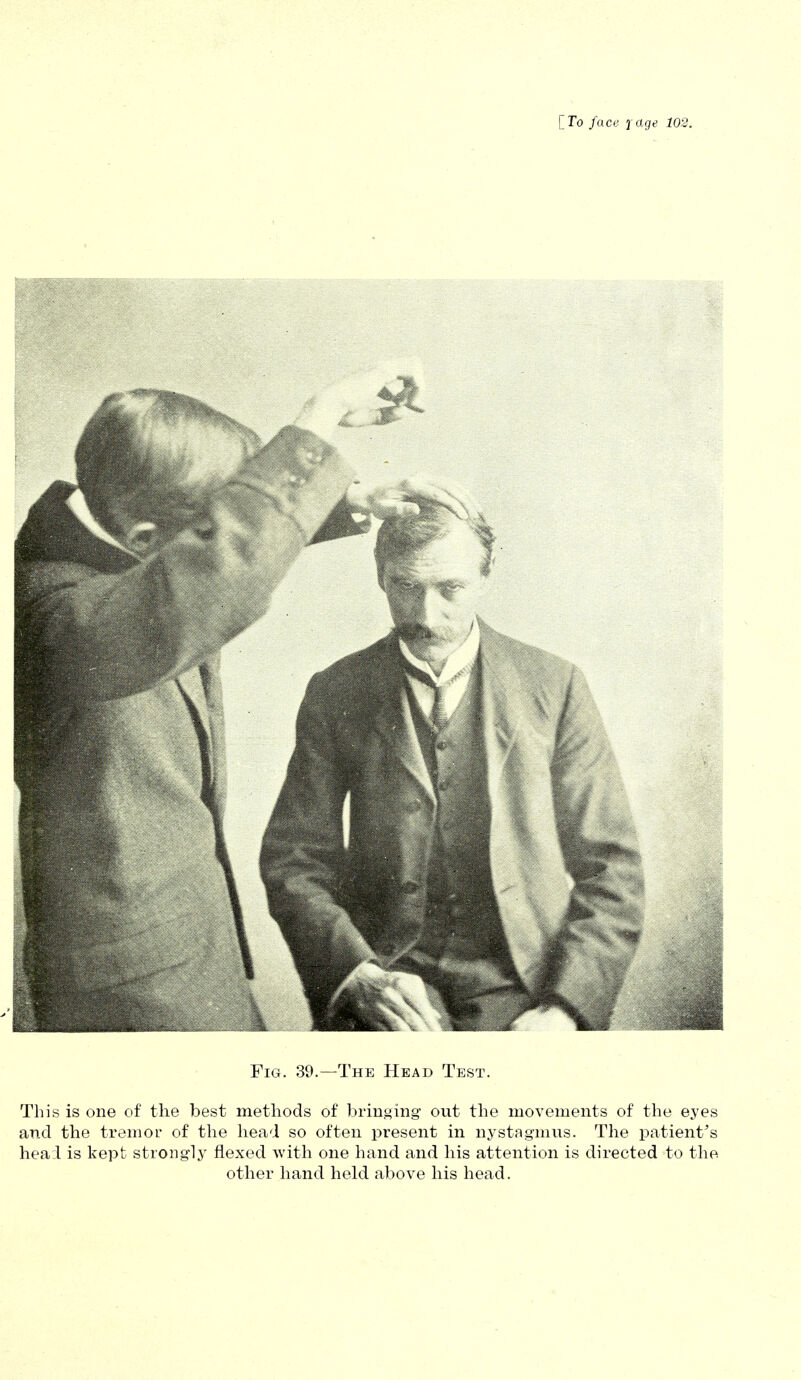Fig. 39.—The Head Test. This is one of the best methods of bringing out the movements of the eyes and the tremor of the head so often present in nystagmus. The patient's head is kept strongly flexed with one hand and his attention is directed to the other hand held above his head.