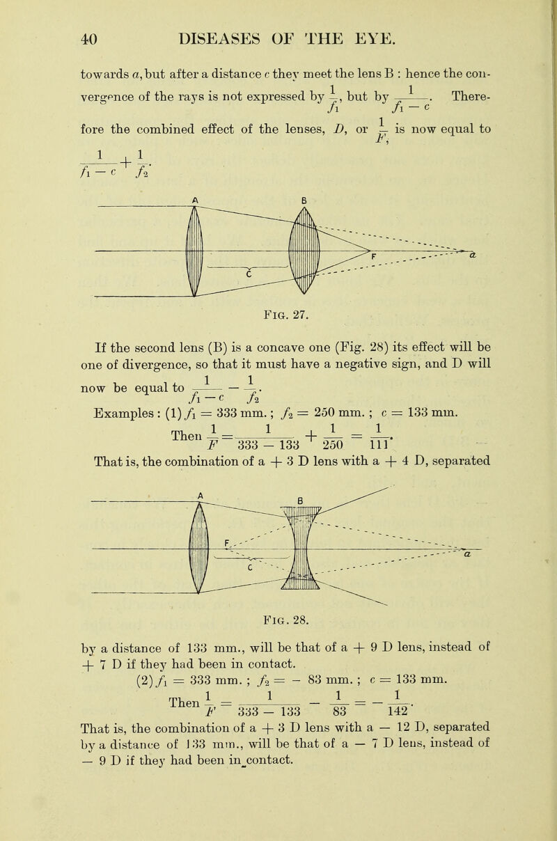 towards a,but after a distance c they meet the lens B : hence the con- vergence of the rays is not expressed by —, but by ——— There- /i fa — c fore the combined effect of the lenses, D, or — is now equal to F, 1 1 fa ~' c fa Fig. 27. If the second lens (B) is a concave one (Fig. 28) its effect will be one of divergence, so that it must have a negative sign, and D will now be equal to ~— — —. Examples : (l)/i = 333 mm.; fa = 250 mm. ; c = 133 mm. m, 1 1 , 1 1 Then —= + - —. F 333 - 133 250 111 That is, the combination of a + 3 D lens with a-f 4D, separated Fig. 28. by a distance of 133 mm., will be that of a -f 9 D lens, instead of + 7 D if they had been in contact. (2)/i = 333 mm. ; fa = - 83 mm. ; c = 133 mm. 1 1 J_ 1 83 Then F 363 - 133 83 142 That is, the combination of a -f 3 D lens with a — 12 D, separated by a distance of J 33 mm., will be that of a — 7 D leus, instead of — 9 D if they had been in^contact.