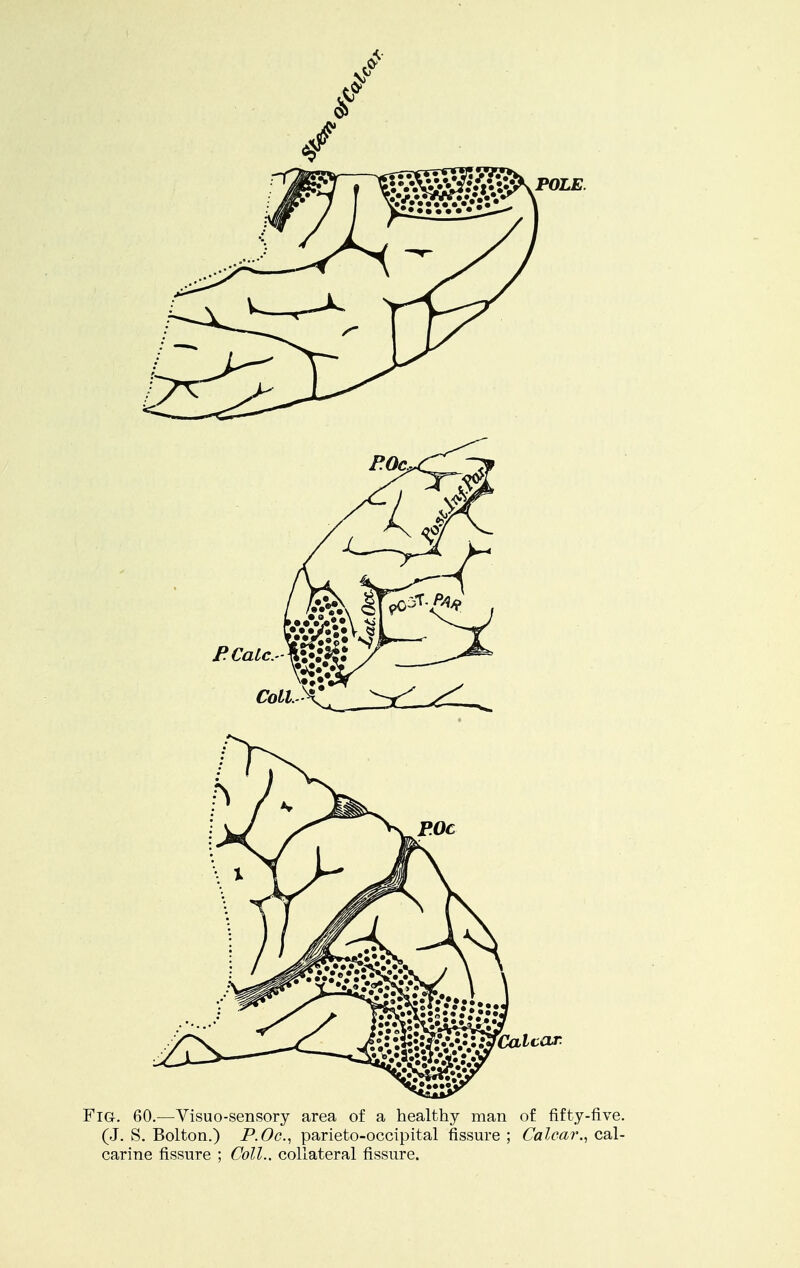 Fig. 60.—Visuo-sensory area of a healthy man of fifty-five. (J. S. Bolton.) P.Oc, parieto-occipital fissure ; Calcar., cal- carine fissure ; Coll.. collateral fissure.