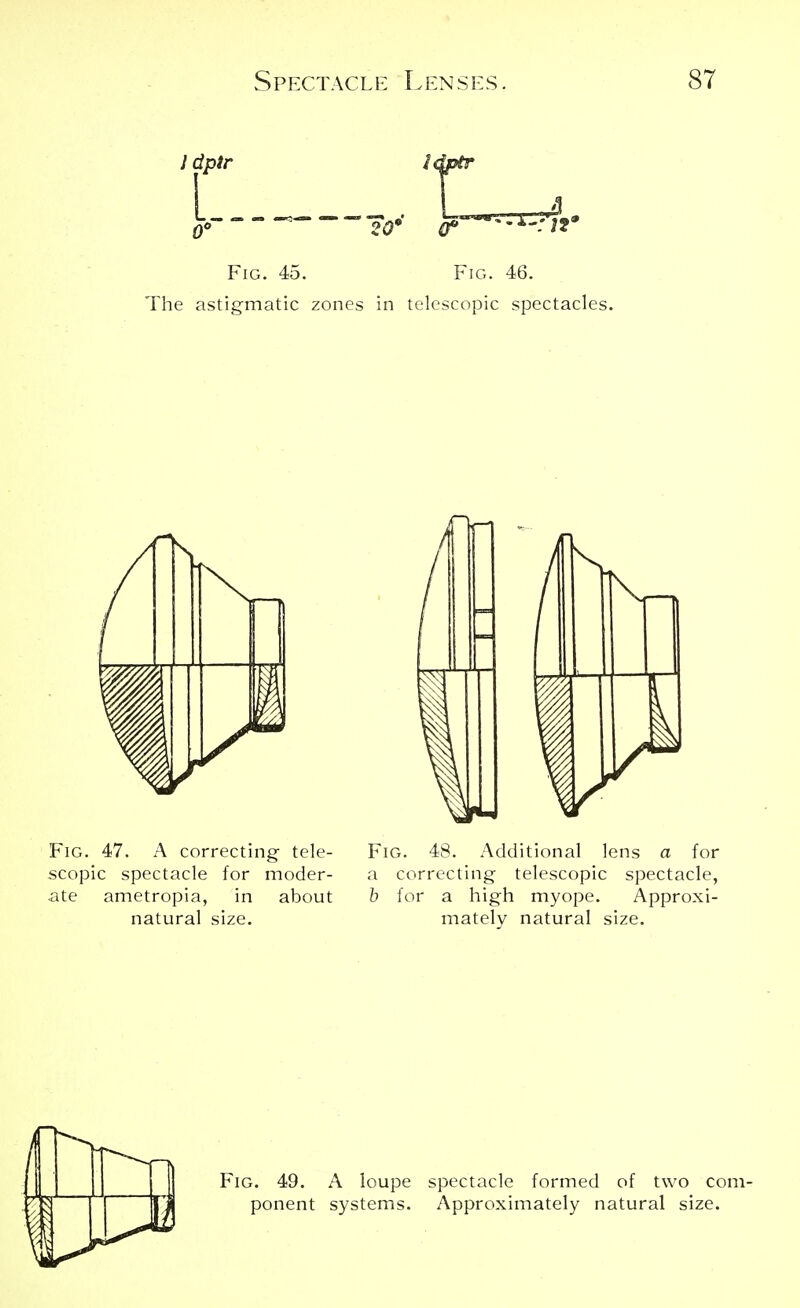 Fig. 45. Fig. 46. The astigmatic zones in telescopic spectacles. Fig. 47. A correcting tele- Fig. 48. Additional lens a for scopic spectacle for moder- a correcting telescopic spectacle, ate ametropia, in about b for a high myope. Approxi- natural size. mately natural size. Fig. 49. A loupe spectacle formed of two com- ponent systems. Approximately natural size.