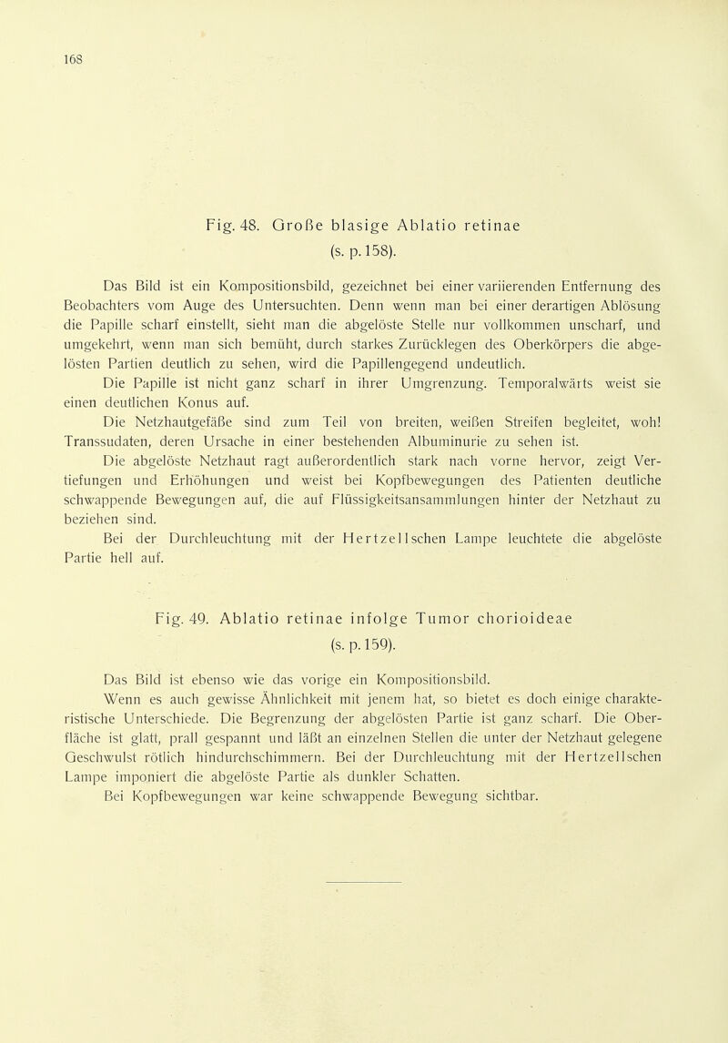 16S Fig. 48. Große blasige Ablatio retinae (s. p.158). Das Bild ist ein Kompositionsbild, gezeichnet bei einer variierenden Entfernung des Beobachters vom Auge des Untersuchten. Denn wenn man bei einer derartigen Ablösung die Papille scharf einstellt, sieht man die abgelöste Stelle nur vollkommen unscharf, und umgekehrt, wenn man sich bemüht, durch starkes Zurücklegen des Oberkörpers die abge- lösten Partien deutlich zu sehen, wird die Papillengegend undeutlich. Die Papille ist nicht ganz scharf in ihrer Umgrenzung. Temporalwärts weist sie einen deutlichen Konus auf. Die Netzhautgefäße sind zum Teil von breiten, weißen Streifen begleitet, wohl Transsudaten, deren Ursache in einer bestehenden Albuminurie zu sehen ist. Die abgelöste Netzhaut ragt außerordentlich stark nach vorne hervor, zeigt Ver- tiefungen und Erhöhungen und weist bei Kopfbewegungen des Patienten deutliche schwappende Bewegungen auf, die auf Flüssigkeitsansammlungen hinter der Netzhaut zu beziehen sind. Bei der Durchleuchtung mit der Hertze 11 sehen Lampe leuchtete die abgelöste Partie hell auf. Fig. 49. Ablatio retinae infolge Tumor chorioideae (s. p. 159). Das Bild ist ebenso wie das vorige ein Kompositionsbild. Wenn es auch gewisse Ähnlichkeit mit jenem hat, so bietet es doch einige charakte- ristische Unterschiede. Die Begrenzung der abgelösten Partie ist ganz scharf. Die Ober- fläche ist glatt, prall gespannt und läßt an einzelnen Stellen die unter der Netzhaut gelegene Geschwulst rötlich hindurchschimmern. Bei der Durchleuchtung mit der Hertzellschen Lampe imponiert die abgelöste Partie als dunkler Schatten. Bei Kopfbewegungen war keine schwappende Bewegung sichtbar.