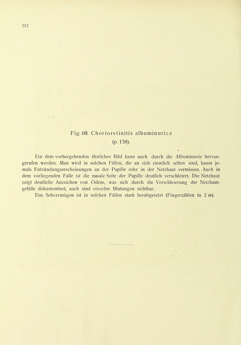 Fig. 69. Chorioretinitis albuminurica (p. 138). Ein dem vorhergehenden ähnliches Bild kann auch durch die Albuminurie hervor- gerufen werden. Man wird in solchen Fällen, die an sich ziemlich selten sind, kaum je- mals Entzündungserscheinungen an der Papille oder in der Netzhaut vermissen. Auch in dem vorliegenden Falle ist die nasale Seite der Papille deutlich verschleiert. Die Netzhaut zeigt deutliche Anzeichen von Ödem, was sich durch die Verschleierung der Netzhaut- gefäße dokumentiert, auch sind einzelne Blutungen sichtbar. Das Sehvermögen ist in solchen Fällen stark herabgesetzt (Fingerzählen in 2 tri).